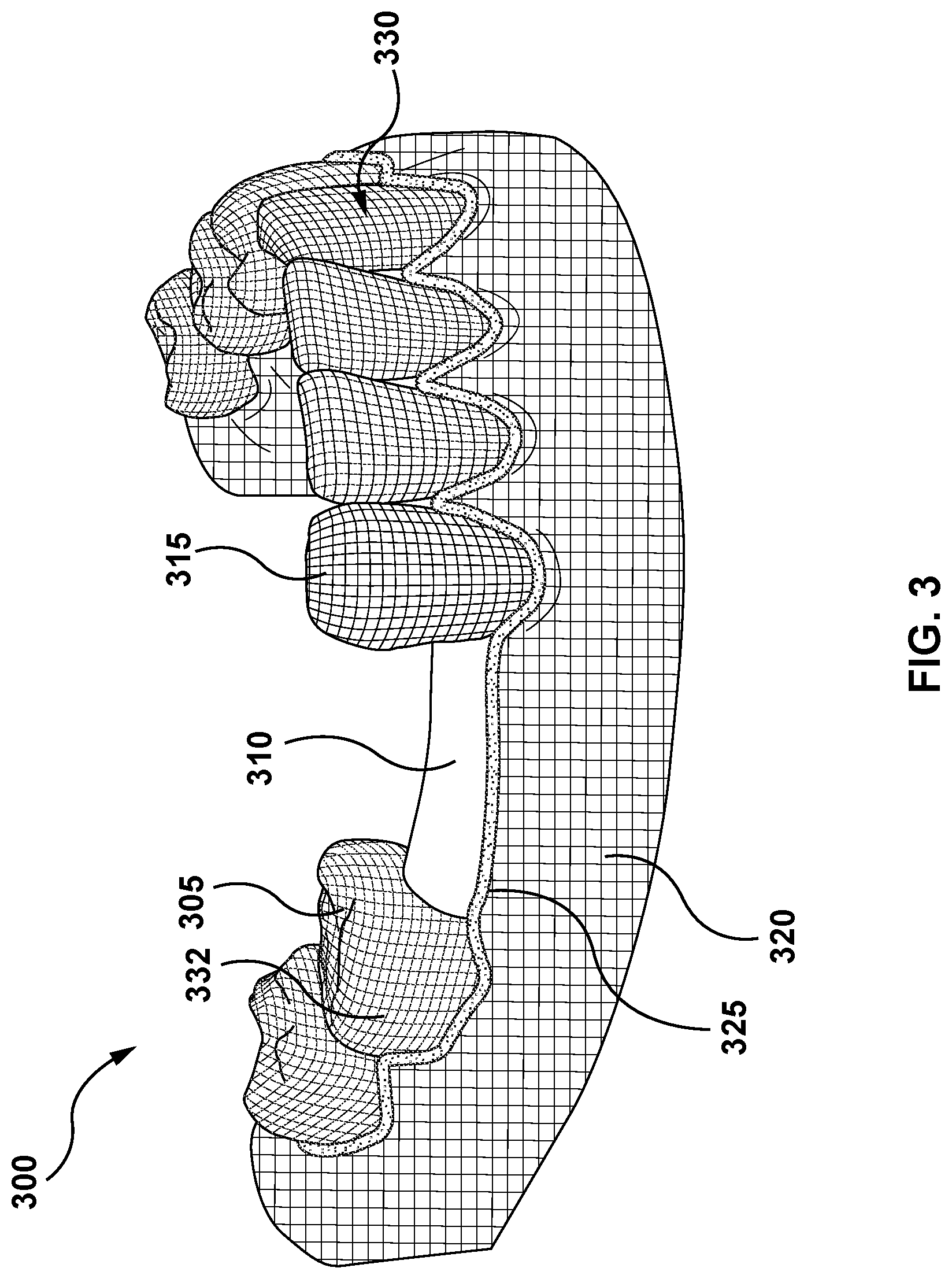 Patent US11771525 Figure 3 – Methods and systems for determining tooth structure
