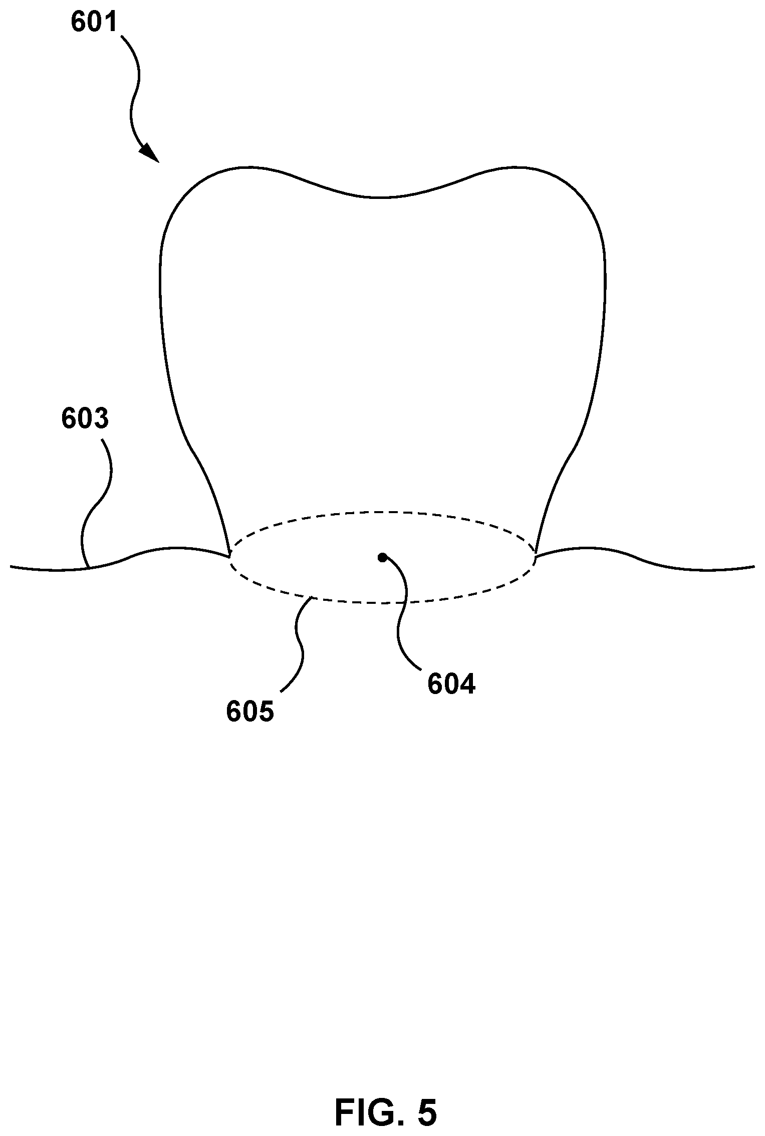 Patent US11771525 Figure 5 – Methods and systems for determining tooth structure