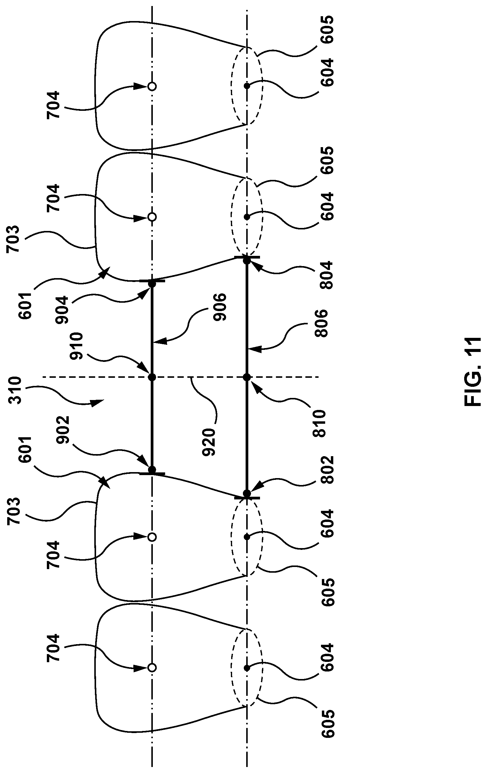 Patent US11771525 Figure 11 – Methods and systems for determining tooth structure