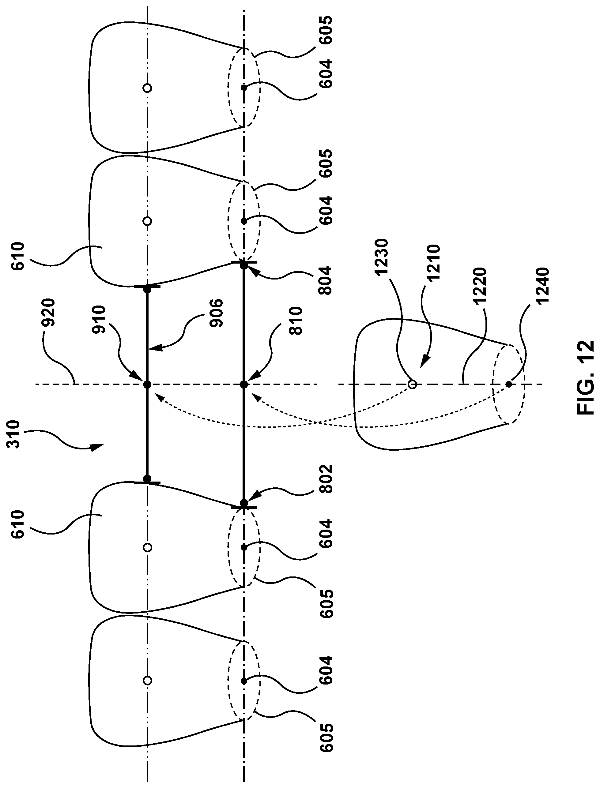 Patent US11771525 Figure 12 – Methods and systems for determining tooth structure