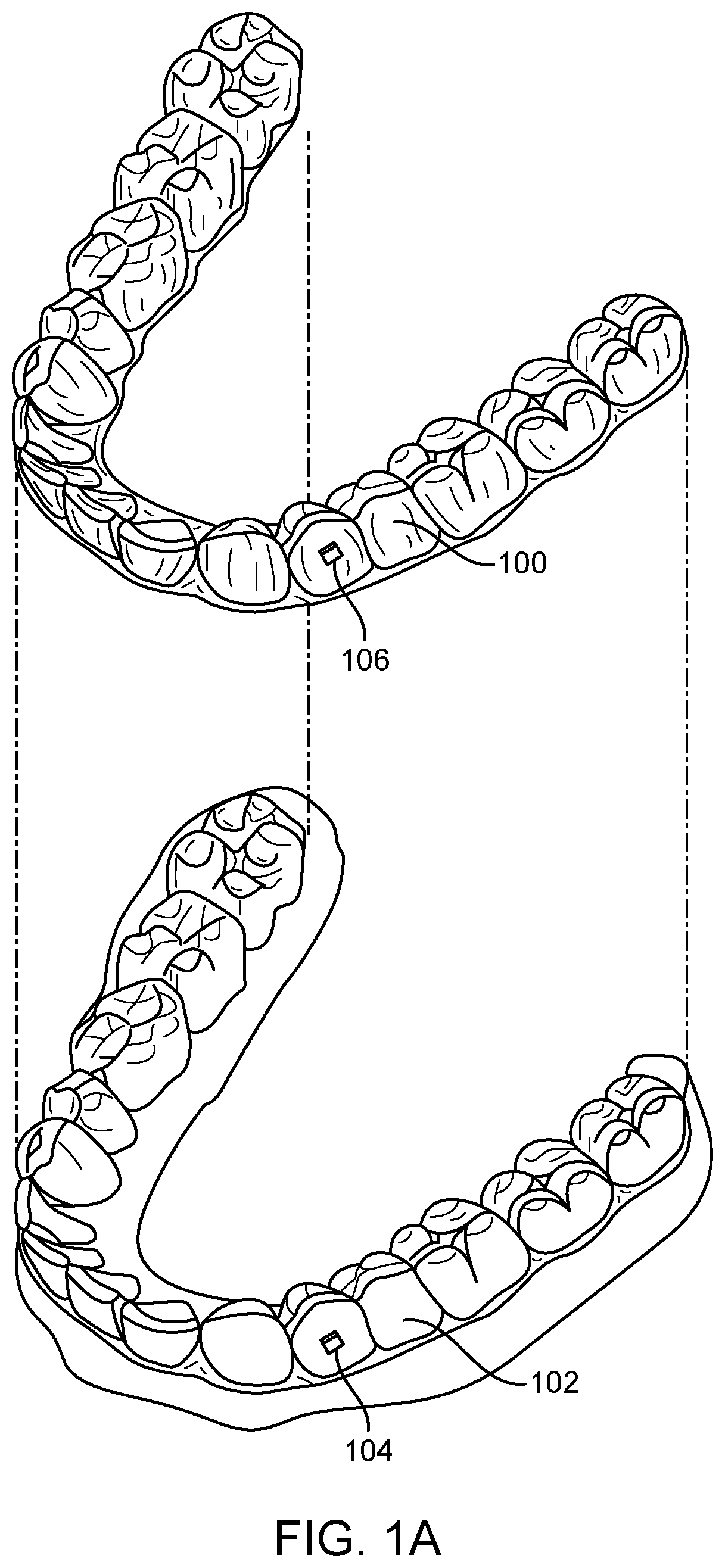 Patent US11771526 Figure 1 – Systems and methods for nonlinear tooth modeling