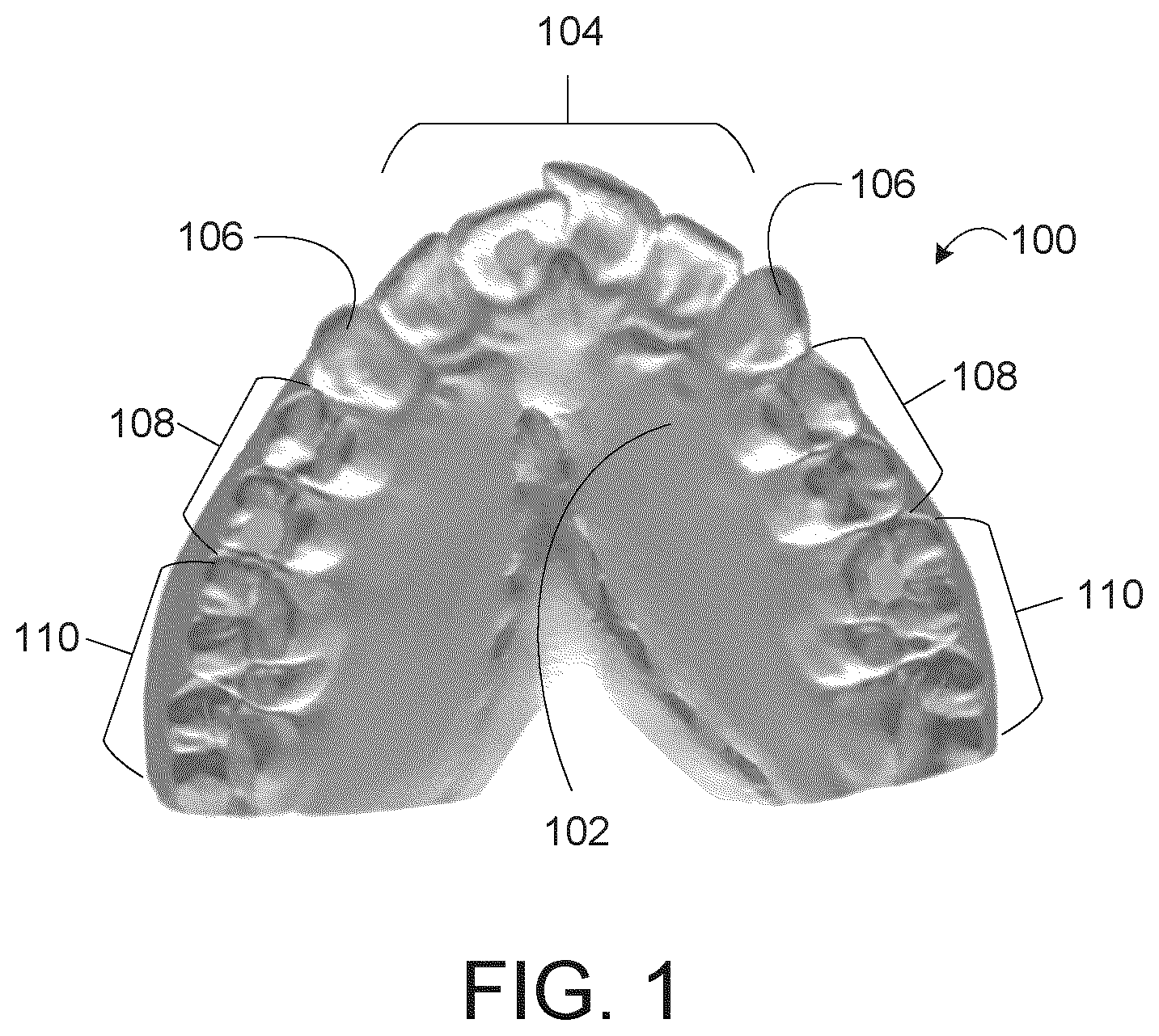 Patent US11771527 Figure 1 – Limited wear aligner and treatment methods