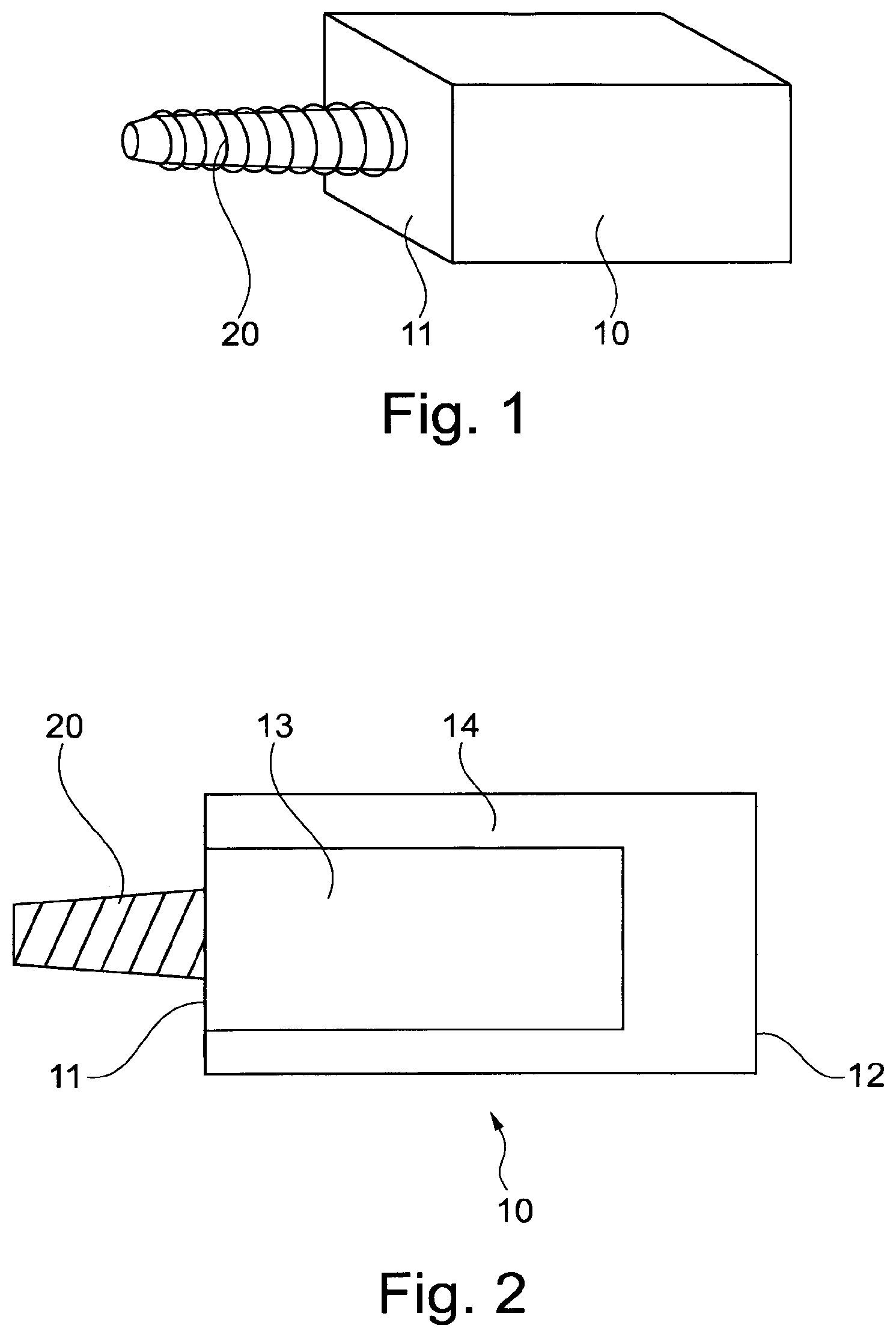 Patent US11771530 Figure 1 – Dental prosthesis forming block and method for producing a dental prosthesis from the dental prosthesis forming block