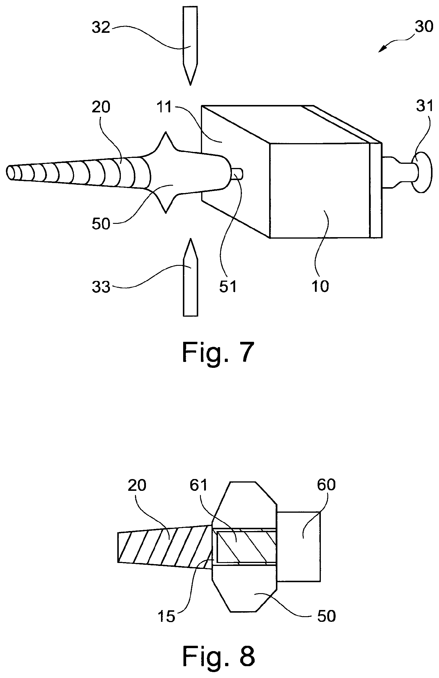 Patent US11771530 Figure 4 – Dental prosthesis forming block and method for producing a dental prosthesis from the dental prosthesis forming block