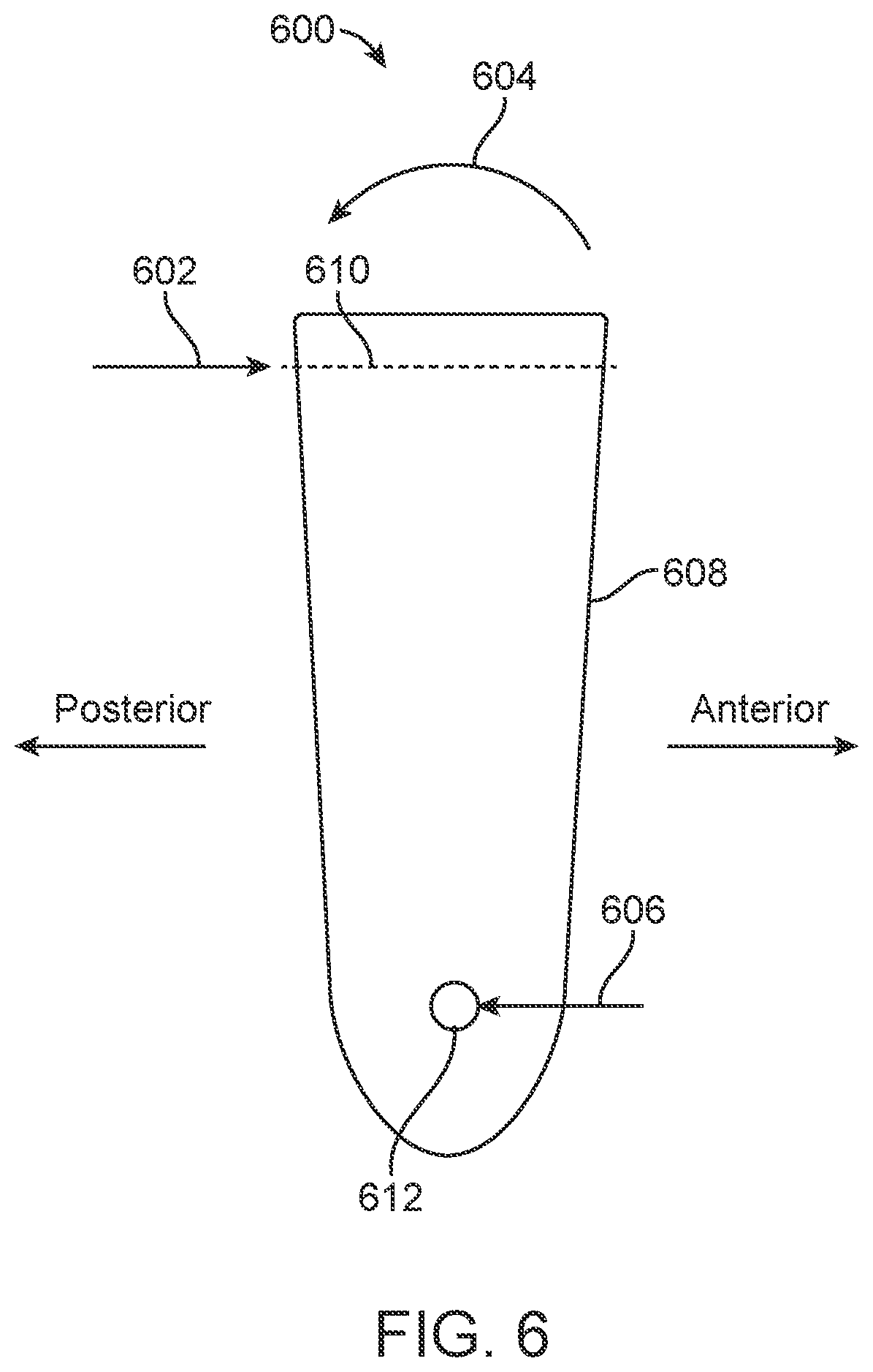 Patent US11771531 Figure 6 – Mandibular advancement and retraction via bone anchoring devices