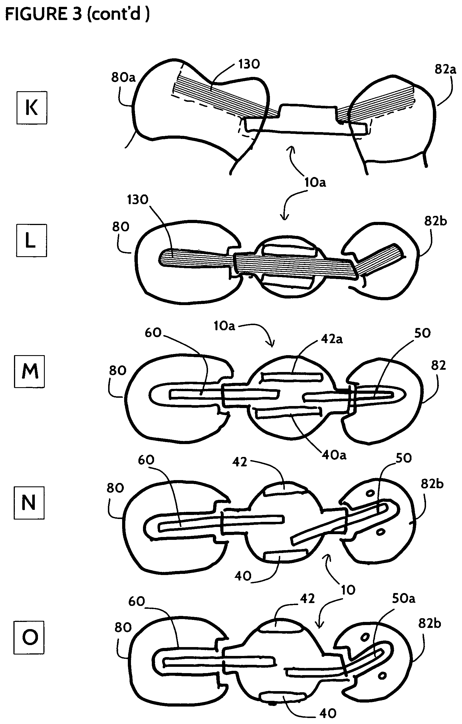Patent US11771532 Figure 5 – Direct dental bridge