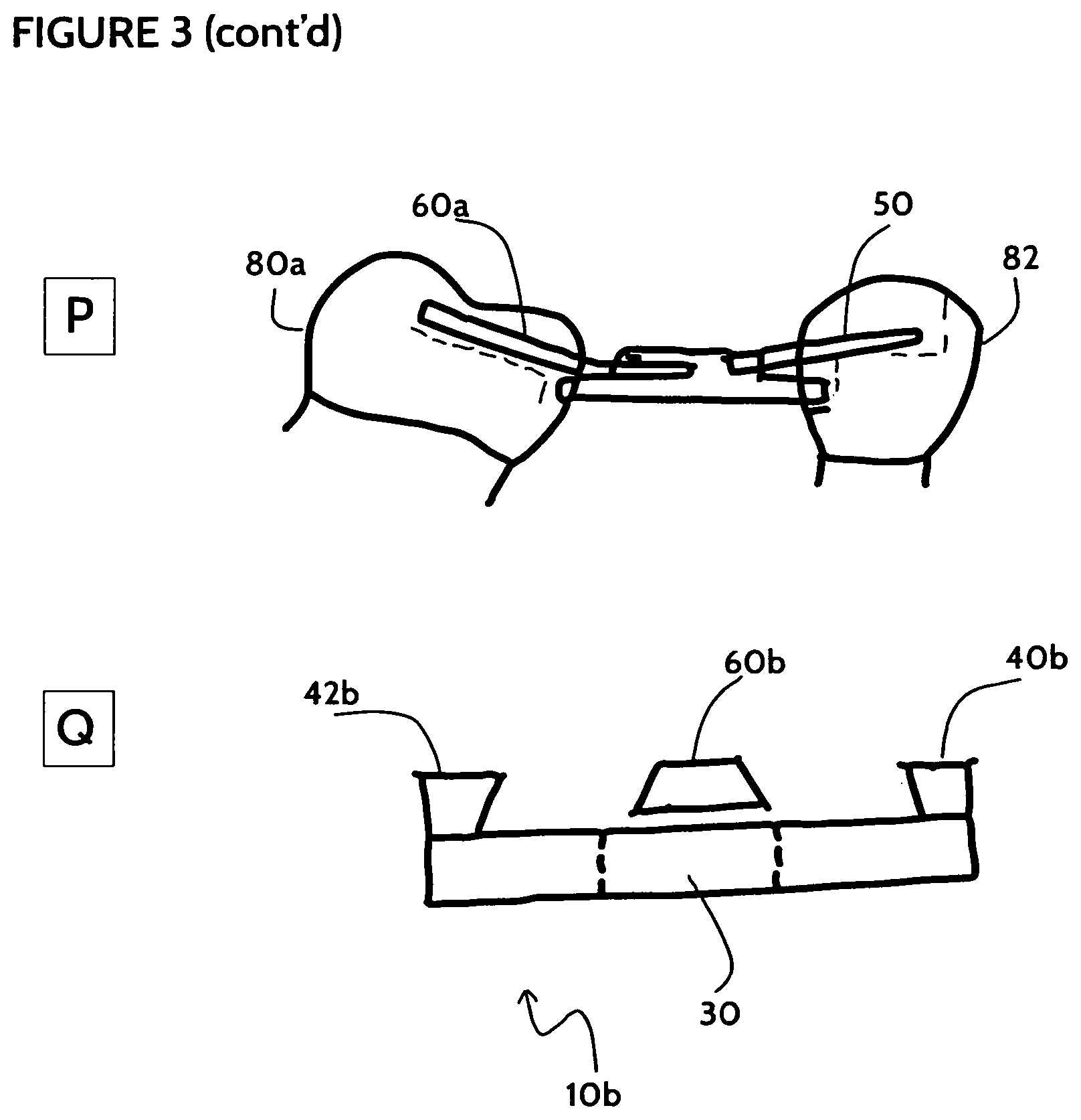Patent US11771532 Figure 6 – Direct dental bridge