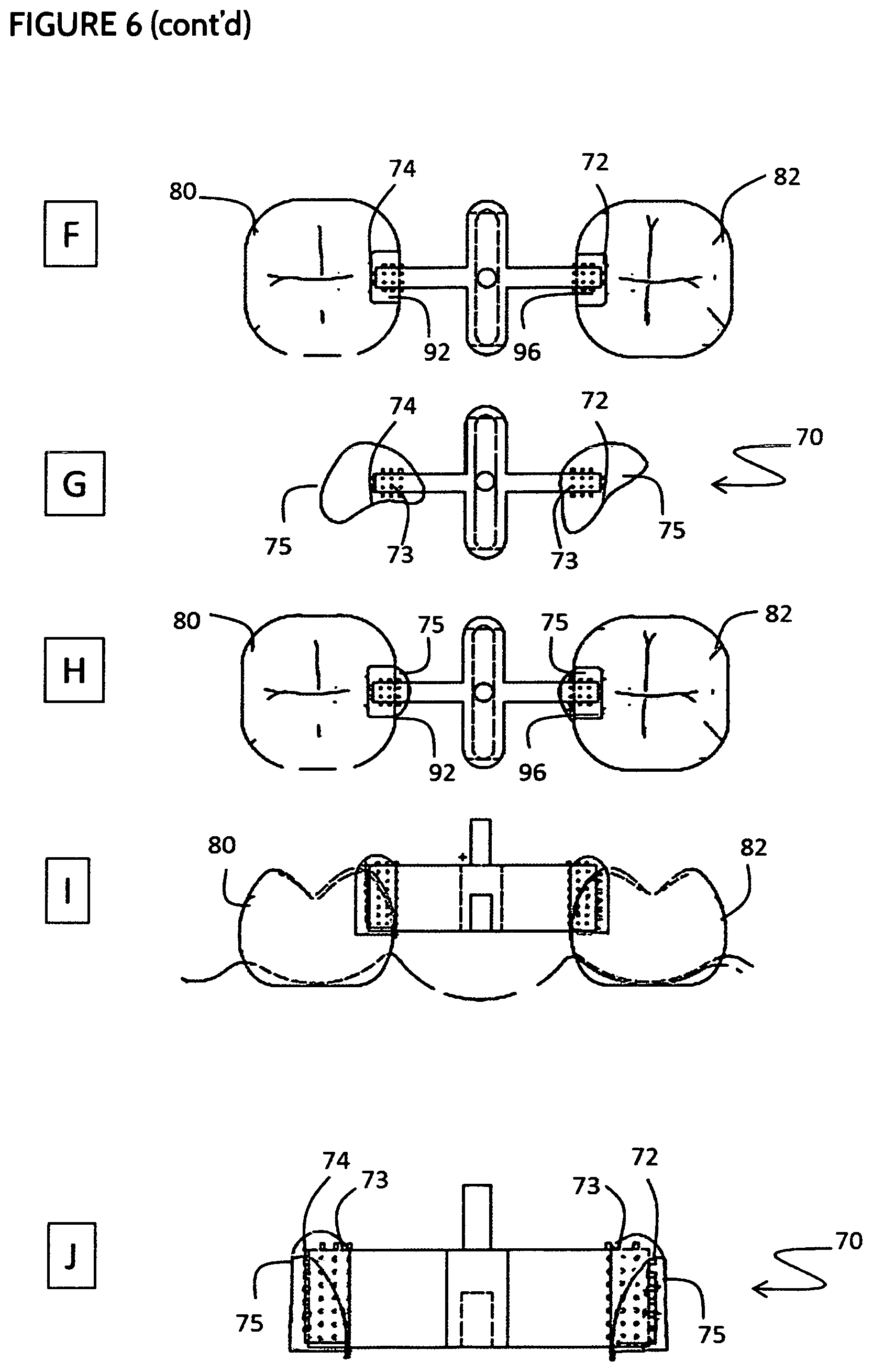 Patent US11771532 Figure 10 – Direct dental bridge