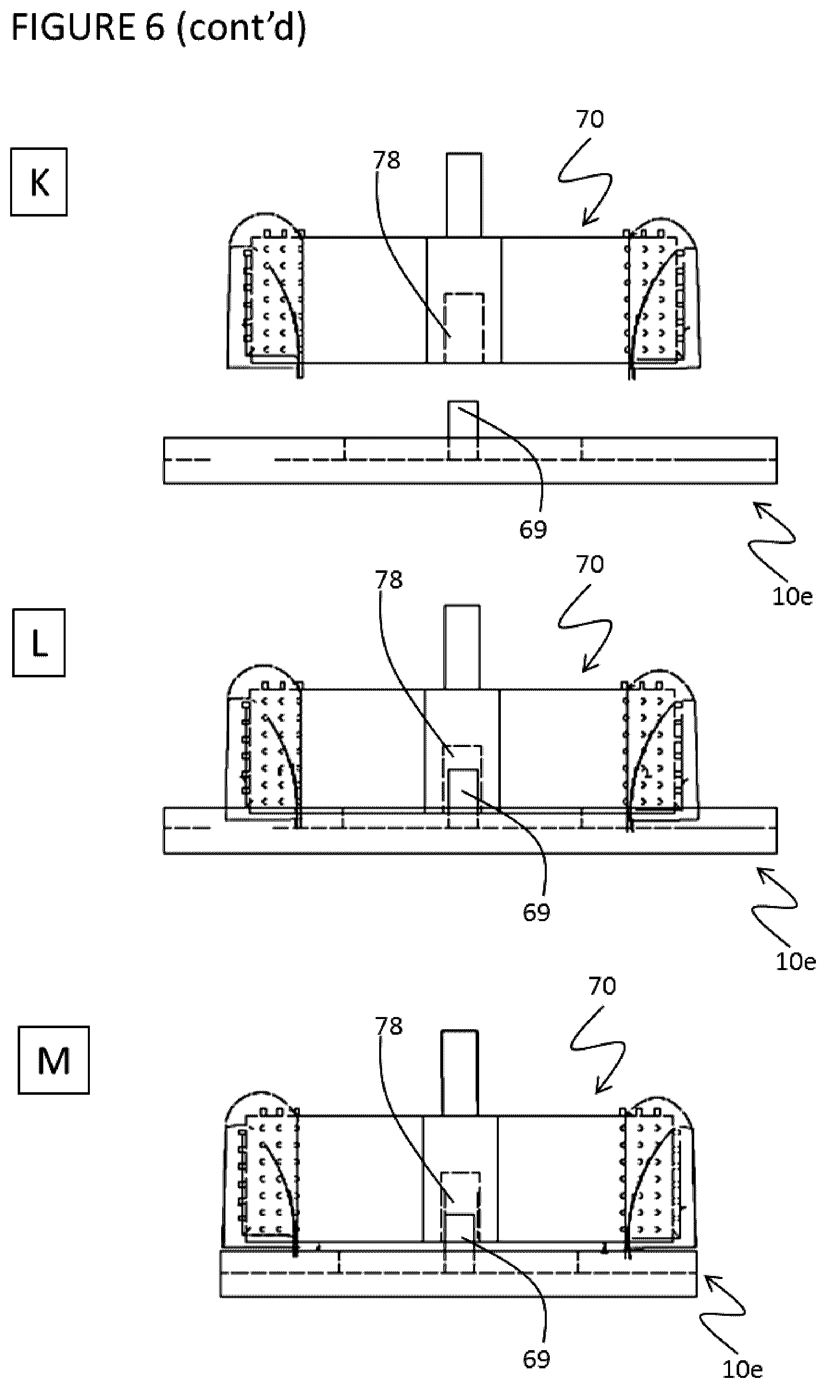 Patent US11771532 Figure 11 – Direct dental bridge