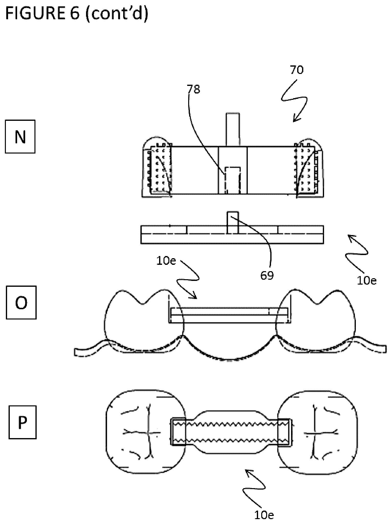 Patent US11771532 Figure 12 – Direct dental bridge