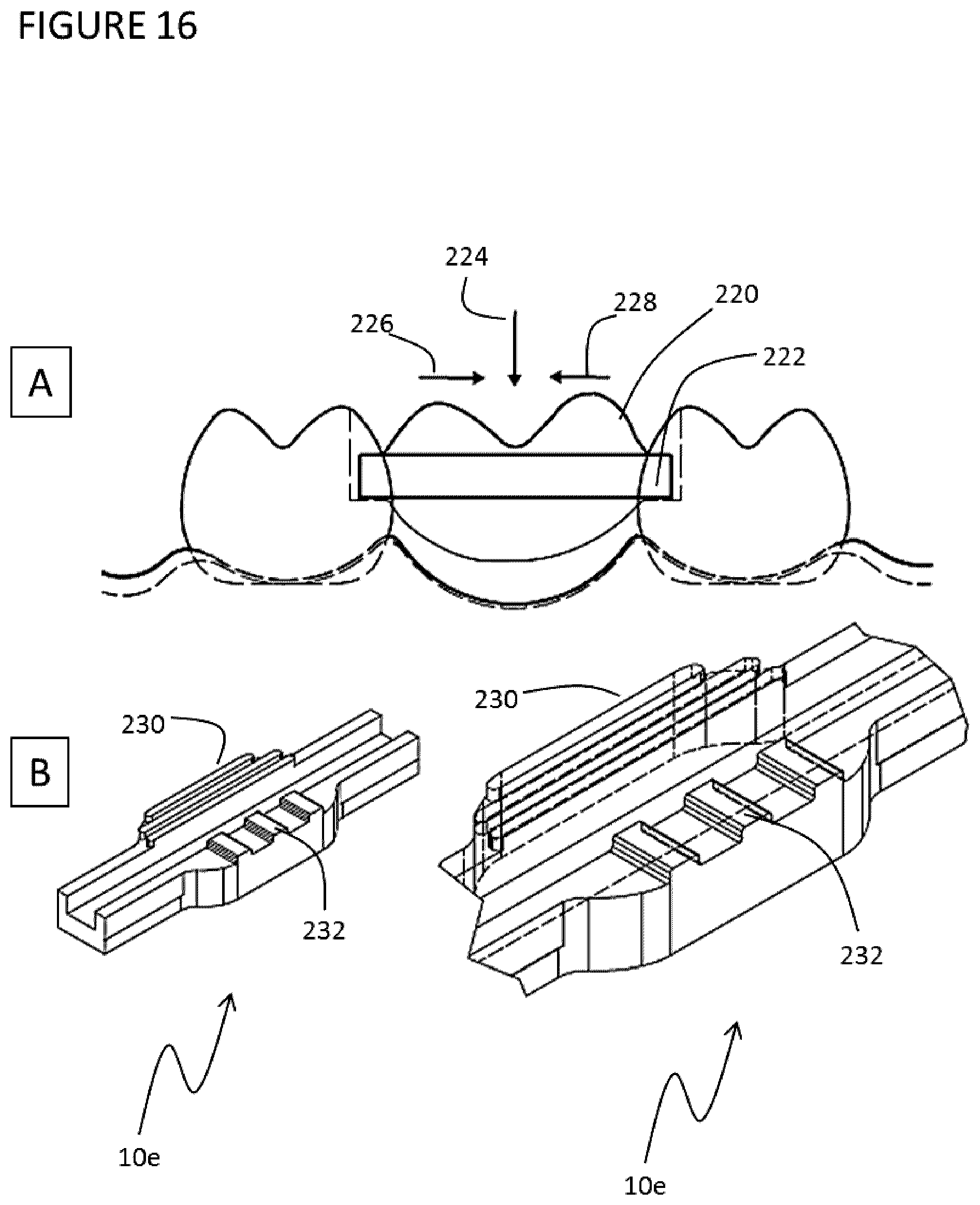 Patent US11771532 Figure 17 – Direct dental bridge