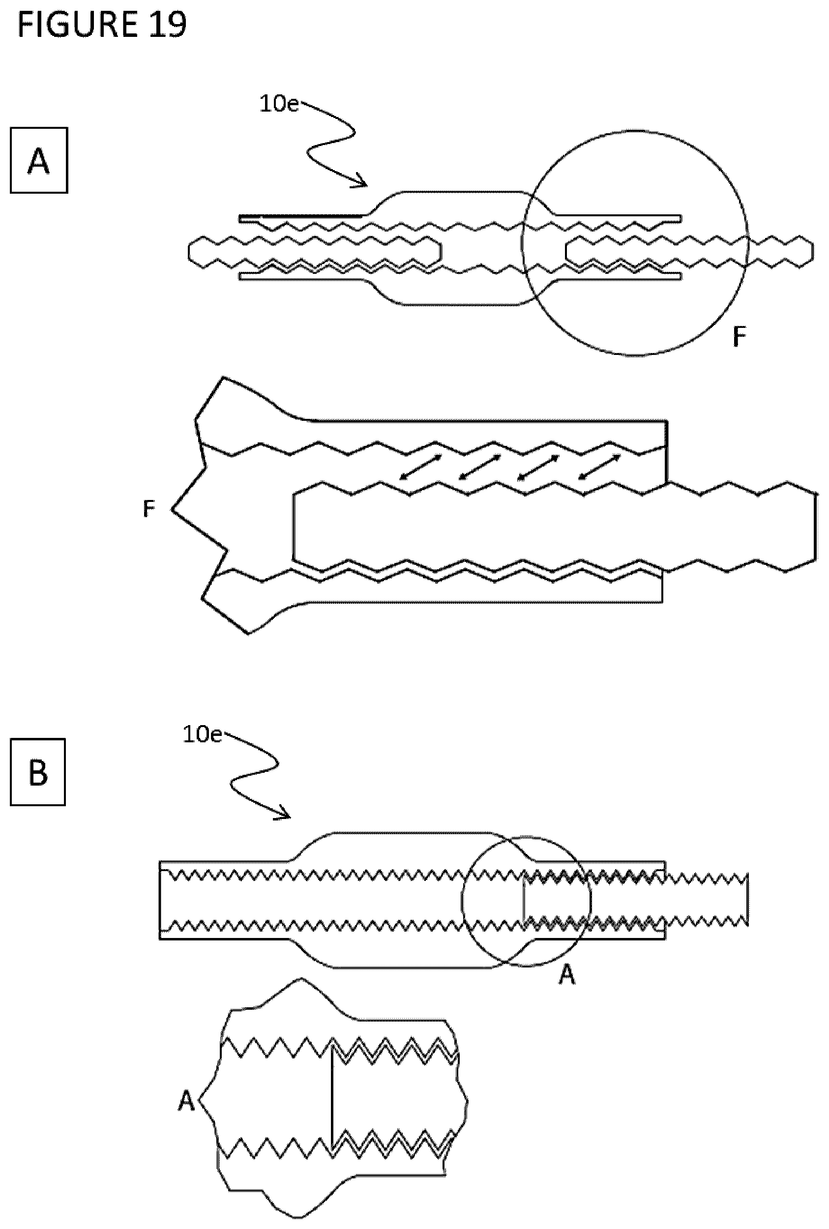Patent US11771532 Figure 20 – Direct dental bridge