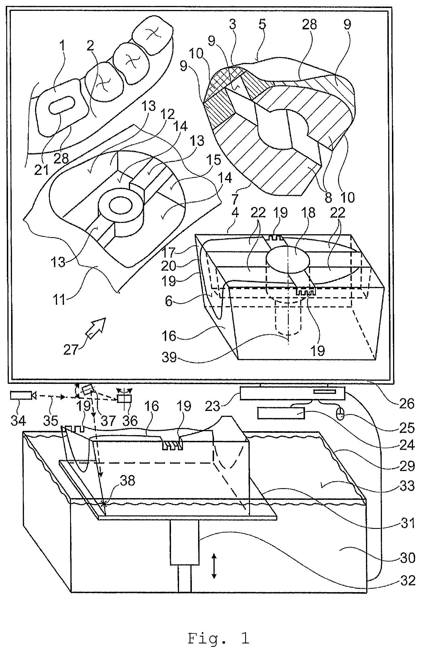 Patent US11771533 Figure 1 – Method for producing an artificial gingiva