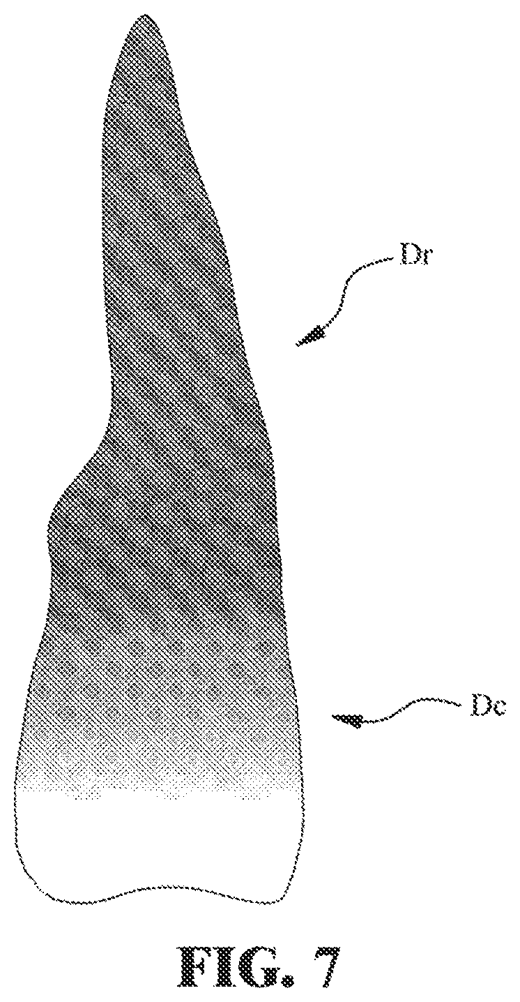 Patent US11771534 Figure 6 – Apparatus and method for three-dimensional laminating a ceramic denture in a color-and-transmittance variable manner