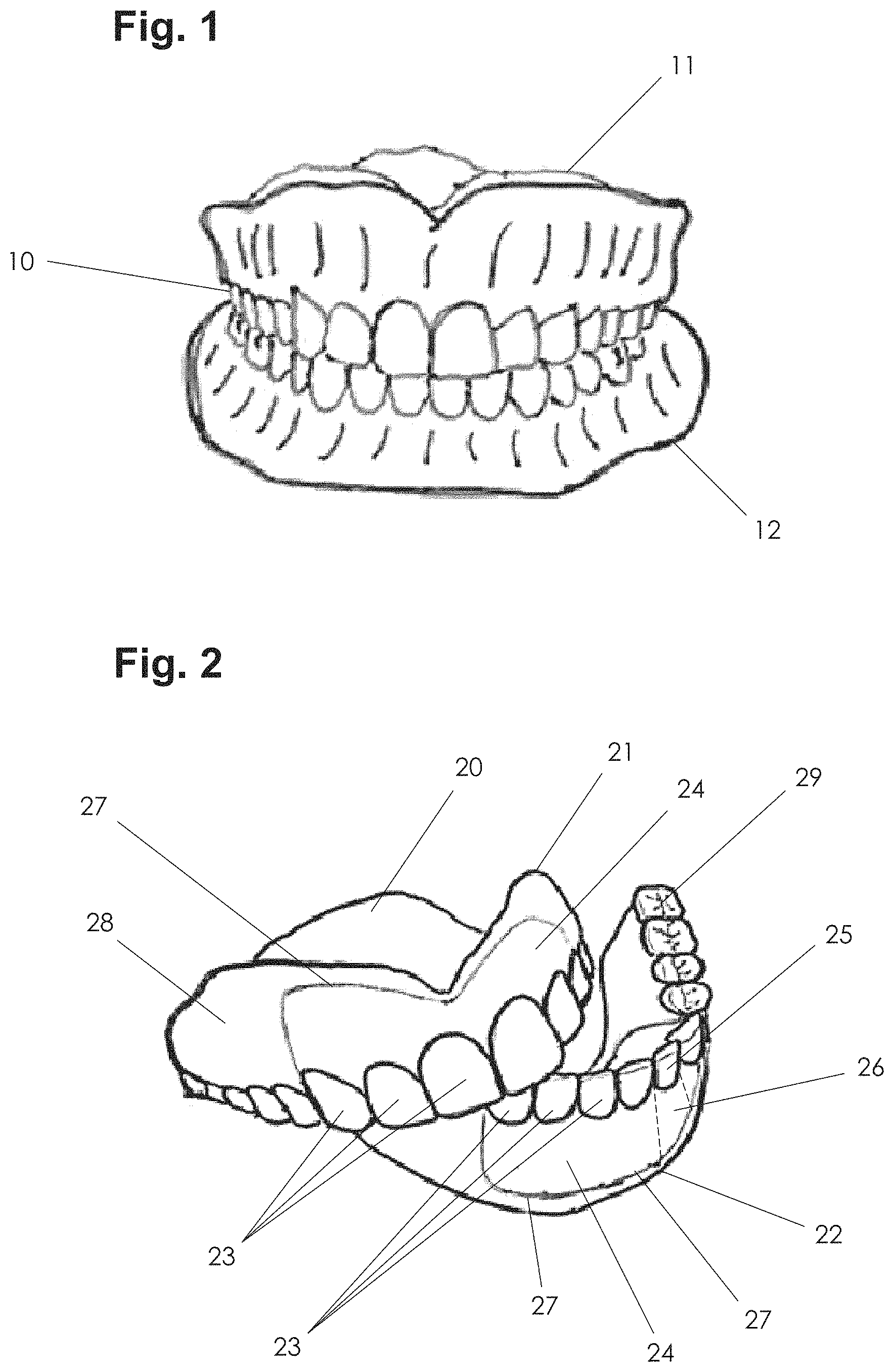 Patent US11771535 Figure 1 – Apparatus and methods of making denture devices