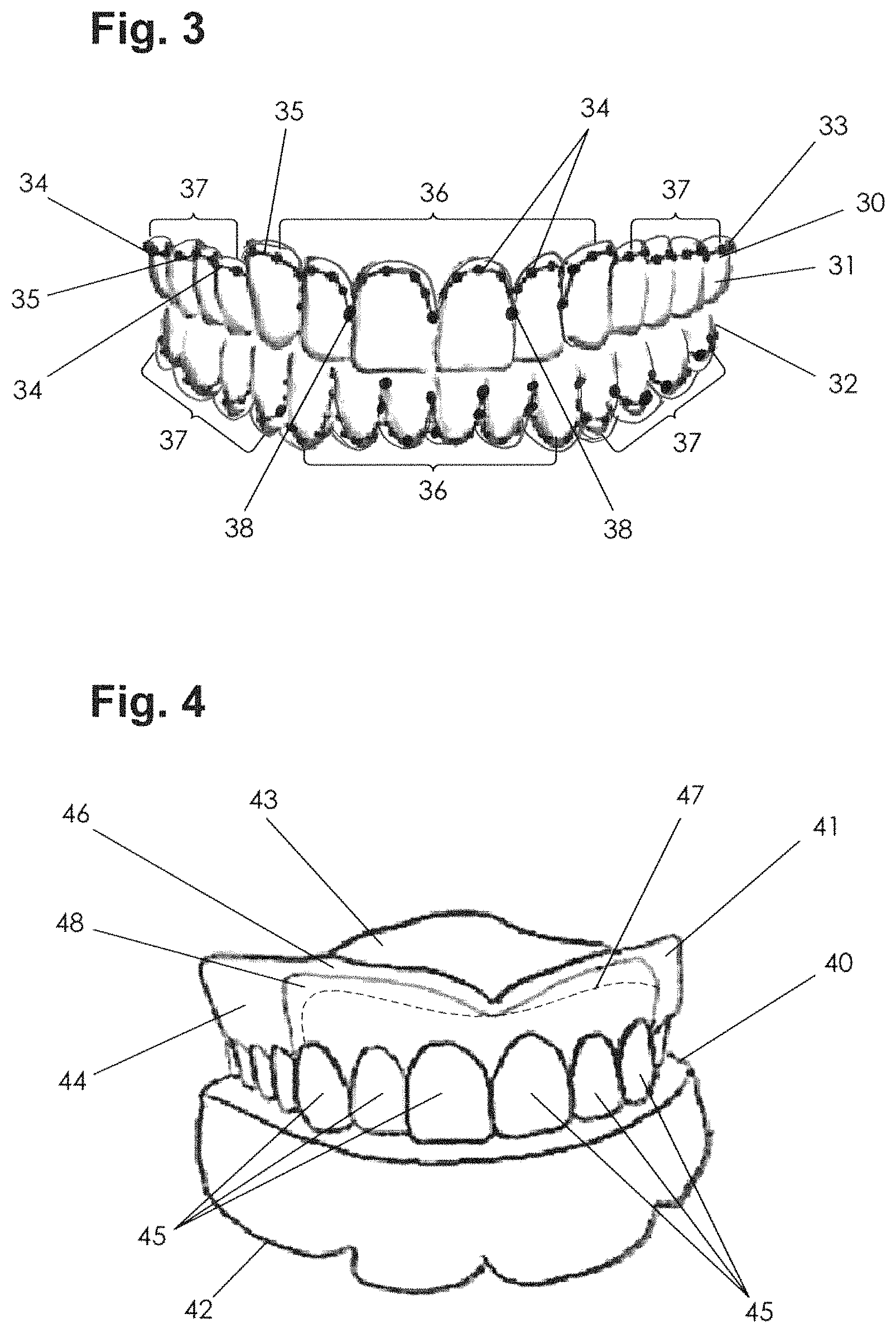 Patent US11771535 Figure 2 – Apparatus and methods of making denture devices