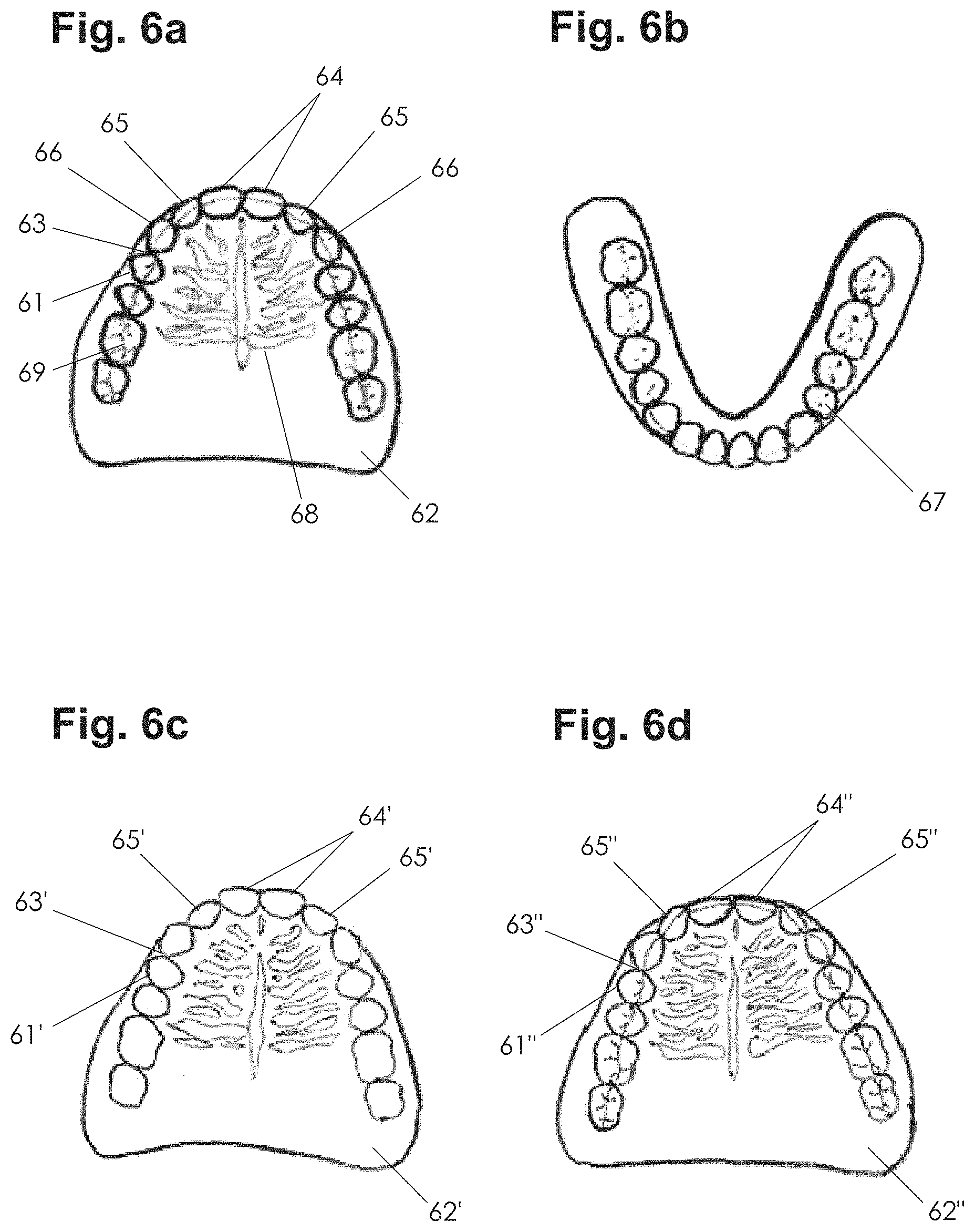 Patent US11771535 Figure 4 – Apparatus and methods of making denture devices