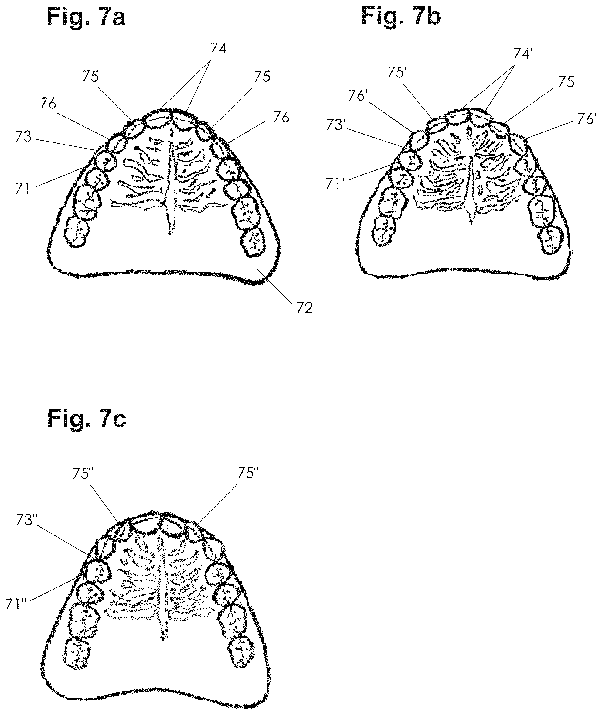 Patent US11771535 Figure 5 – Apparatus and methods of making denture devices