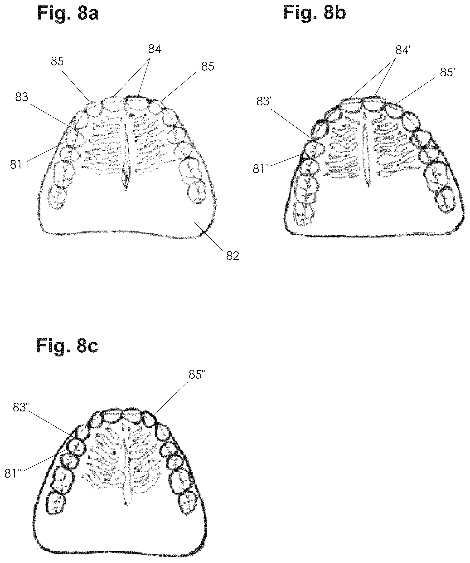 Patent US11771535 Figure 6 – Apparatus and methods of making denture devices