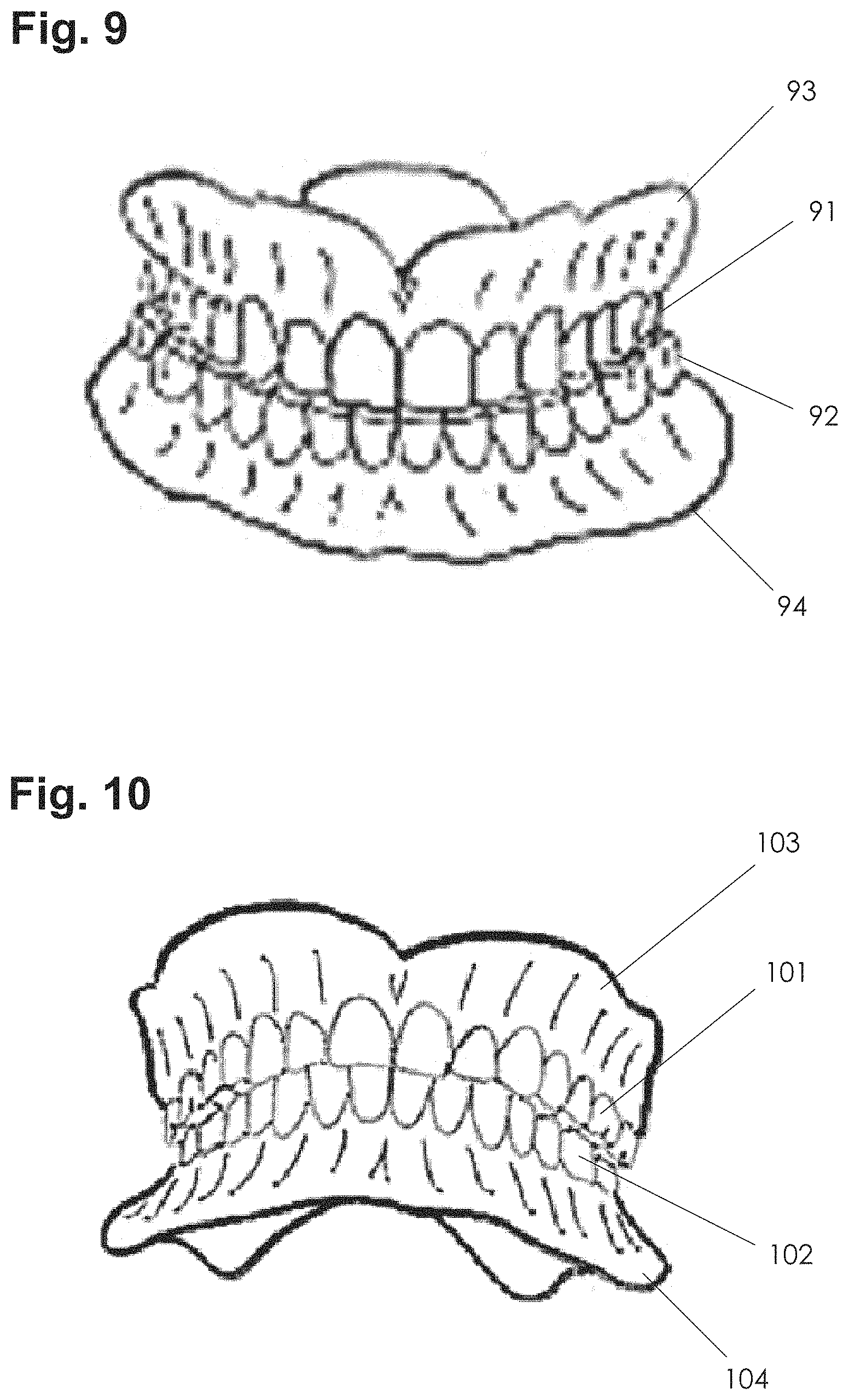 Patent US11771535 Figure 7 – Apparatus and methods of making denture devices