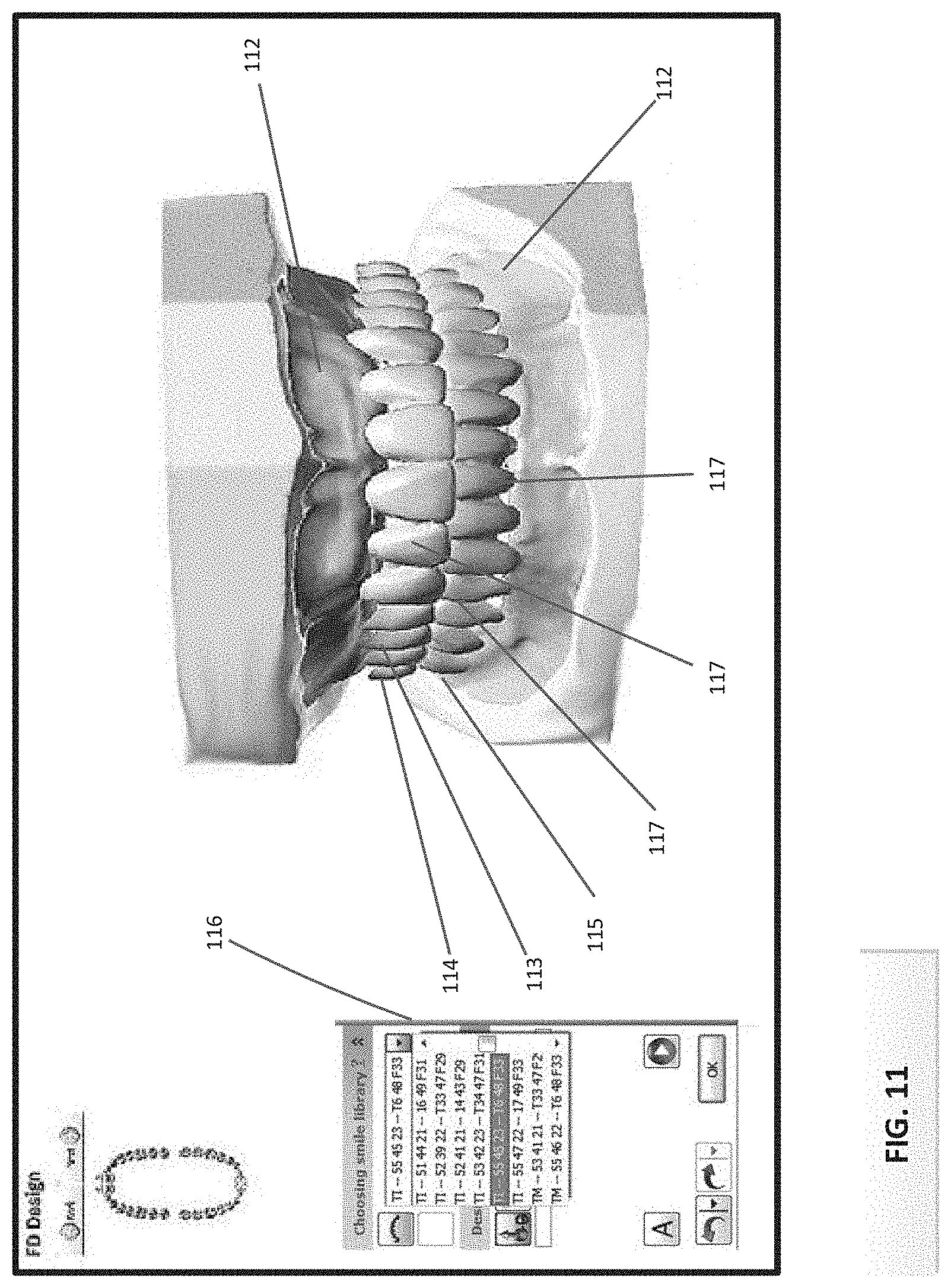 Patent US11771535 Figure 8 – Apparatus and methods of making denture devices