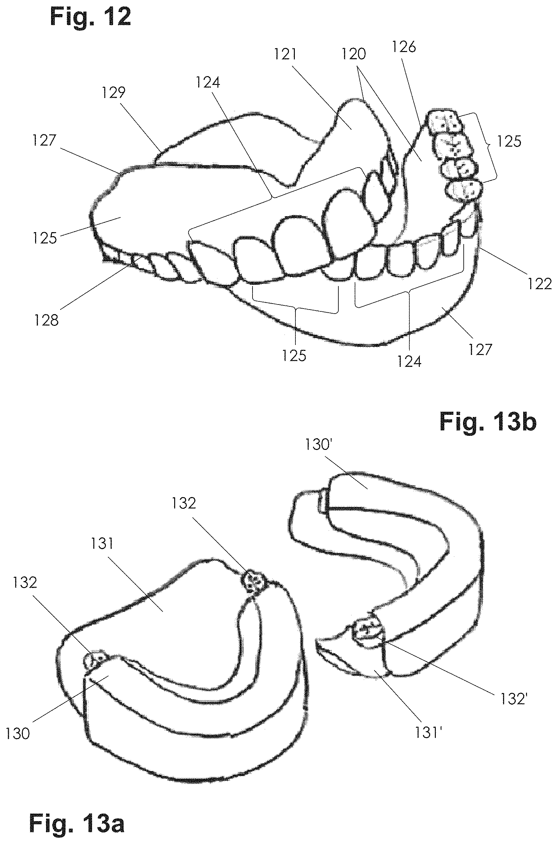 Patent US11771535 Figure 9 – Apparatus and methods of making denture devices