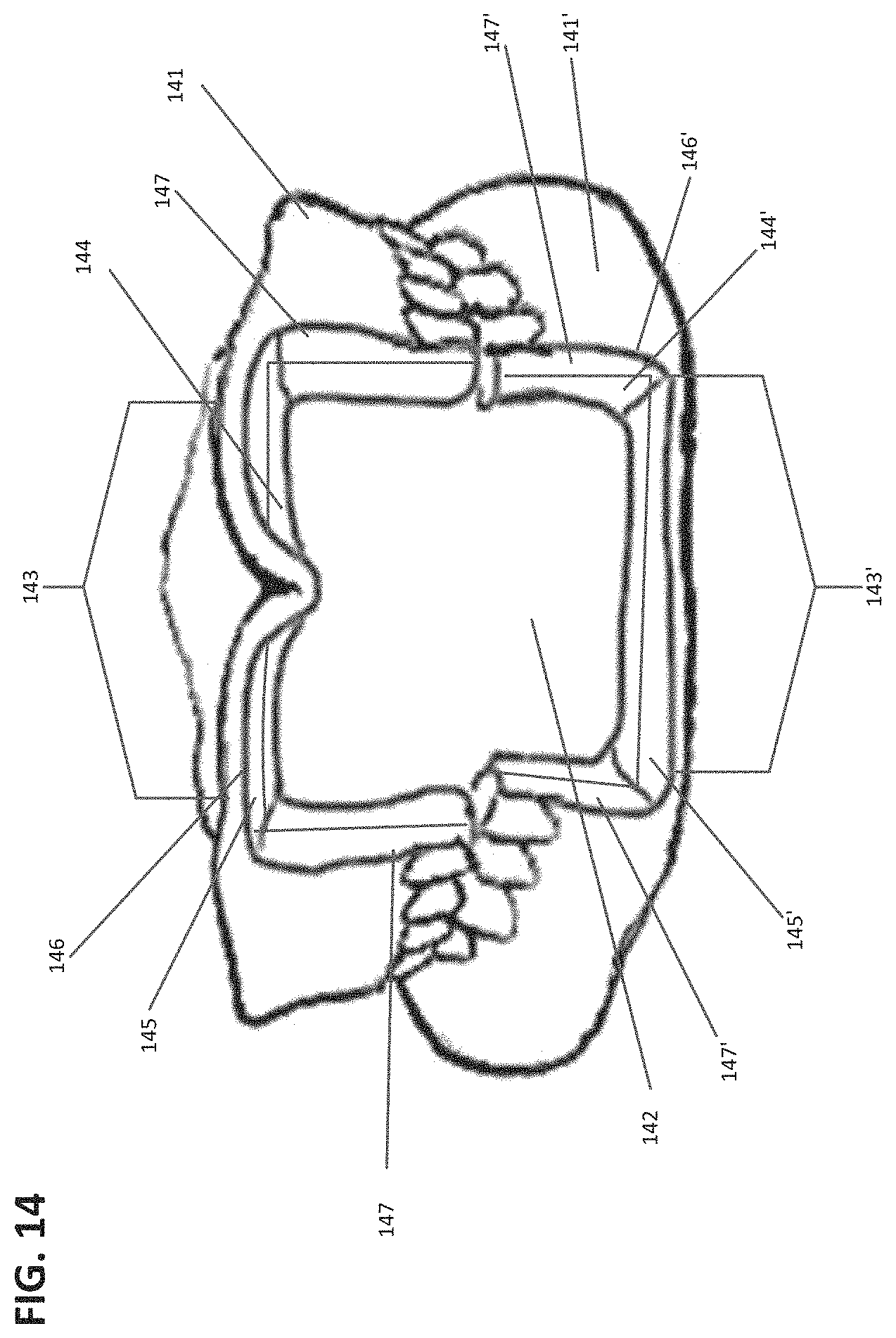 Patent US11771535 Figure 10 – Apparatus and methods of making denture devices