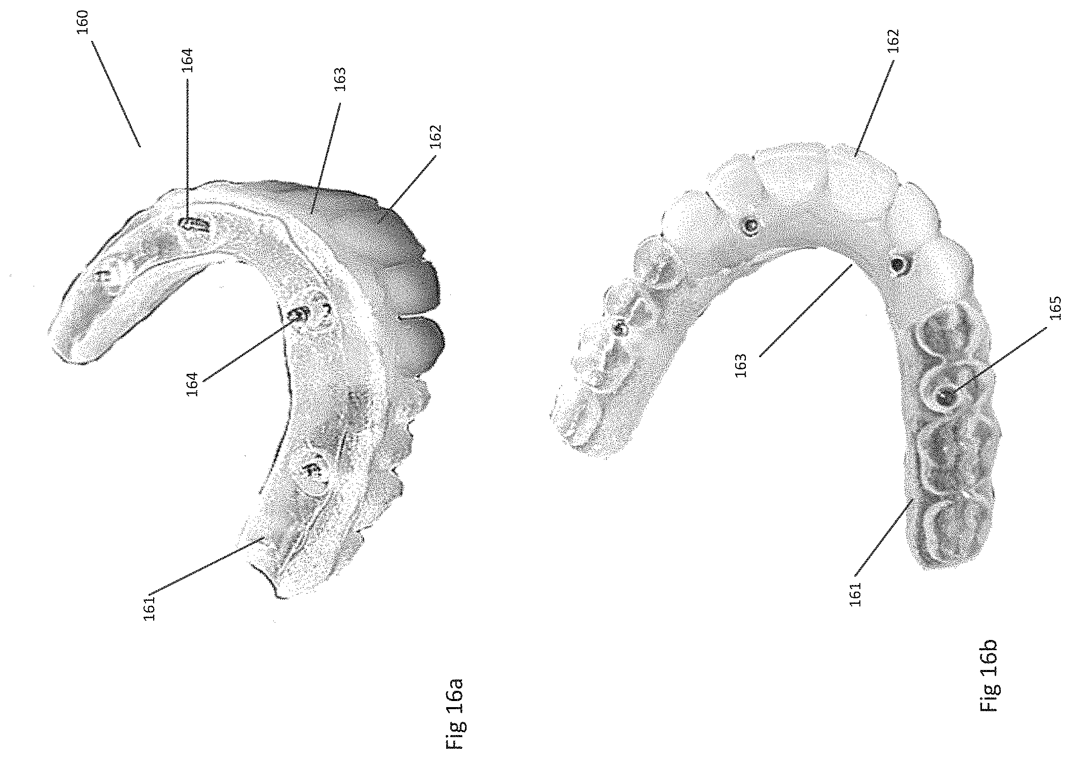 Patent US11771535 Figure 12 – Apparatus and methods of making denture devices
