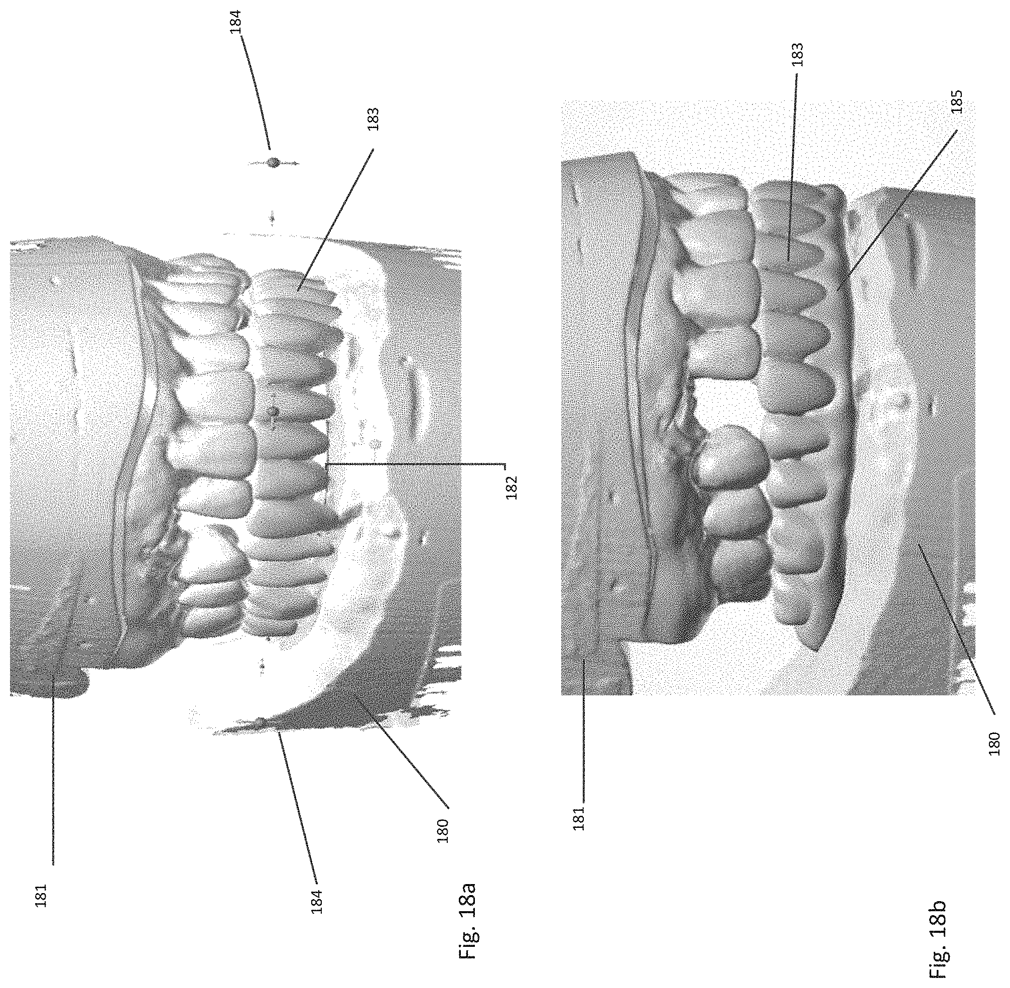 Patent US11771535 Figure 14 – Apparatus and methods of making denture devices