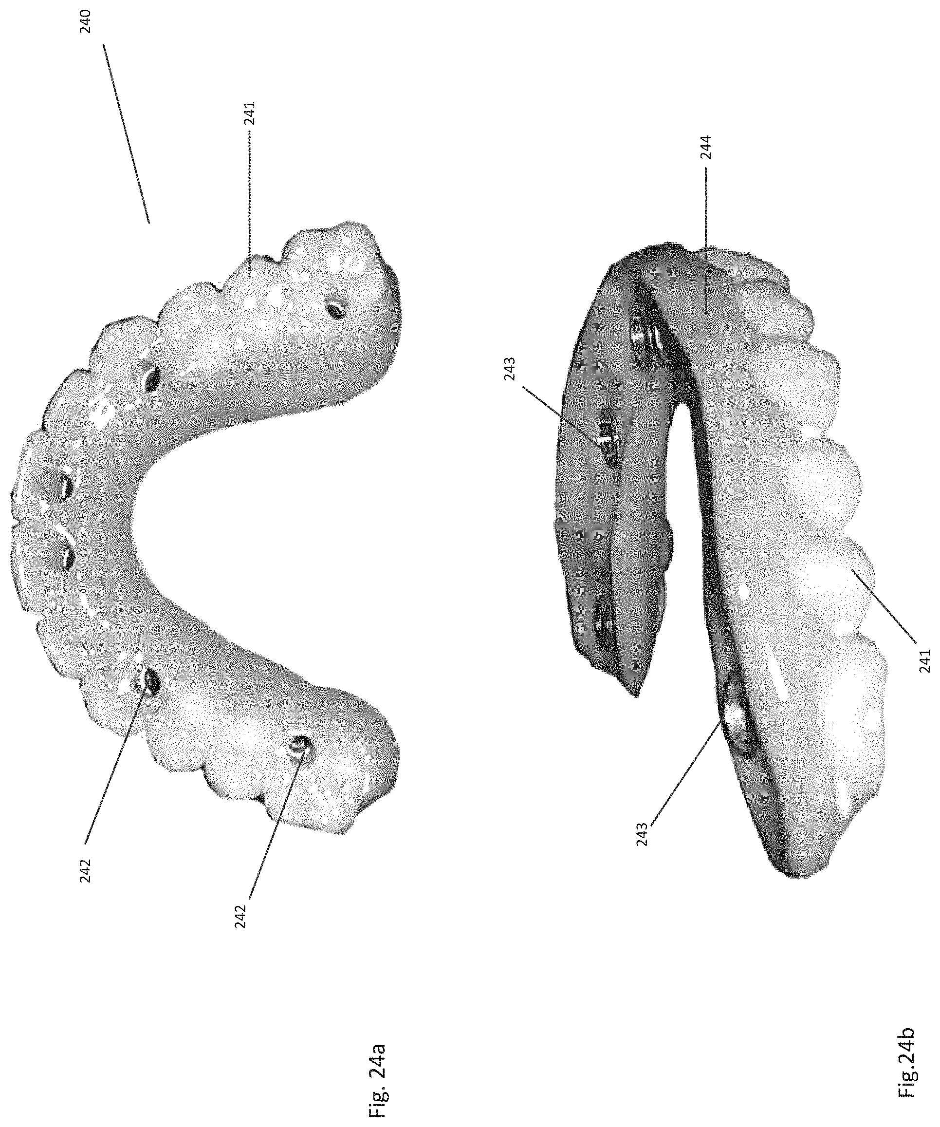 Patent US11771535 Figure 20 – Apparatus and methods of making denture devices