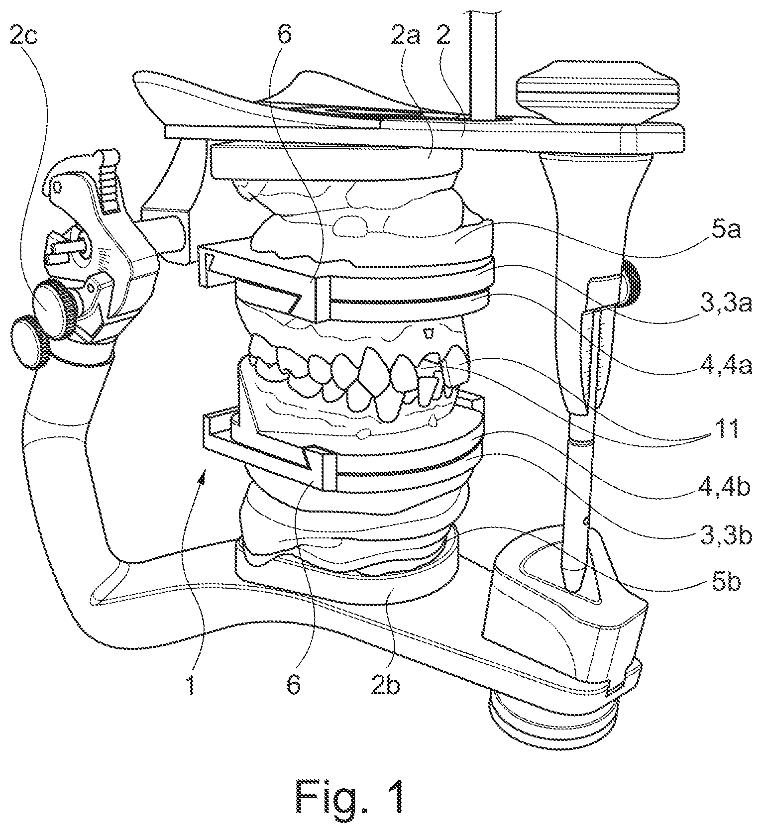 Patent US11771536 — Method for producing a dental working model — Figure 1