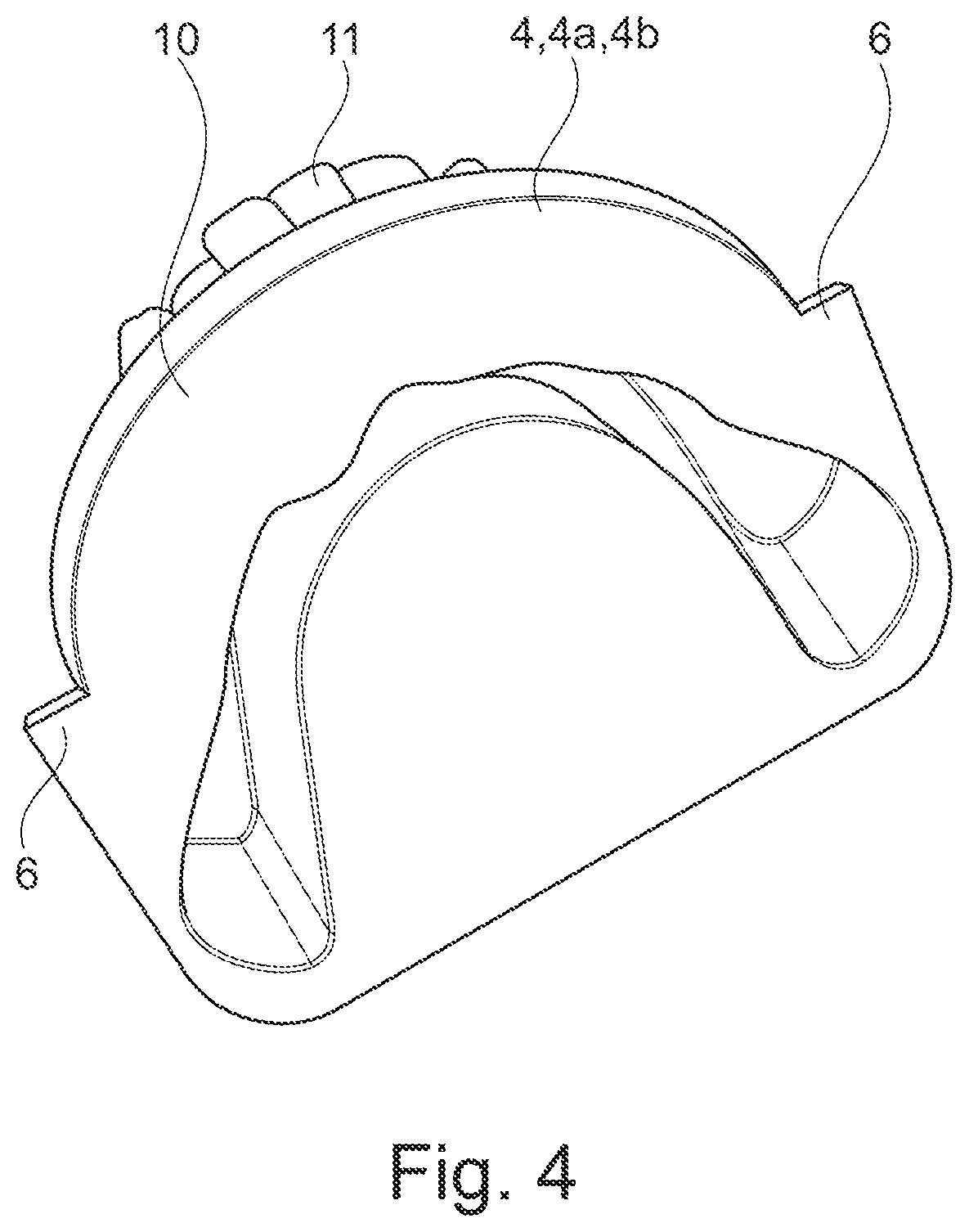 Patent US11771536 Figure 4 – Method for producing a dental working model