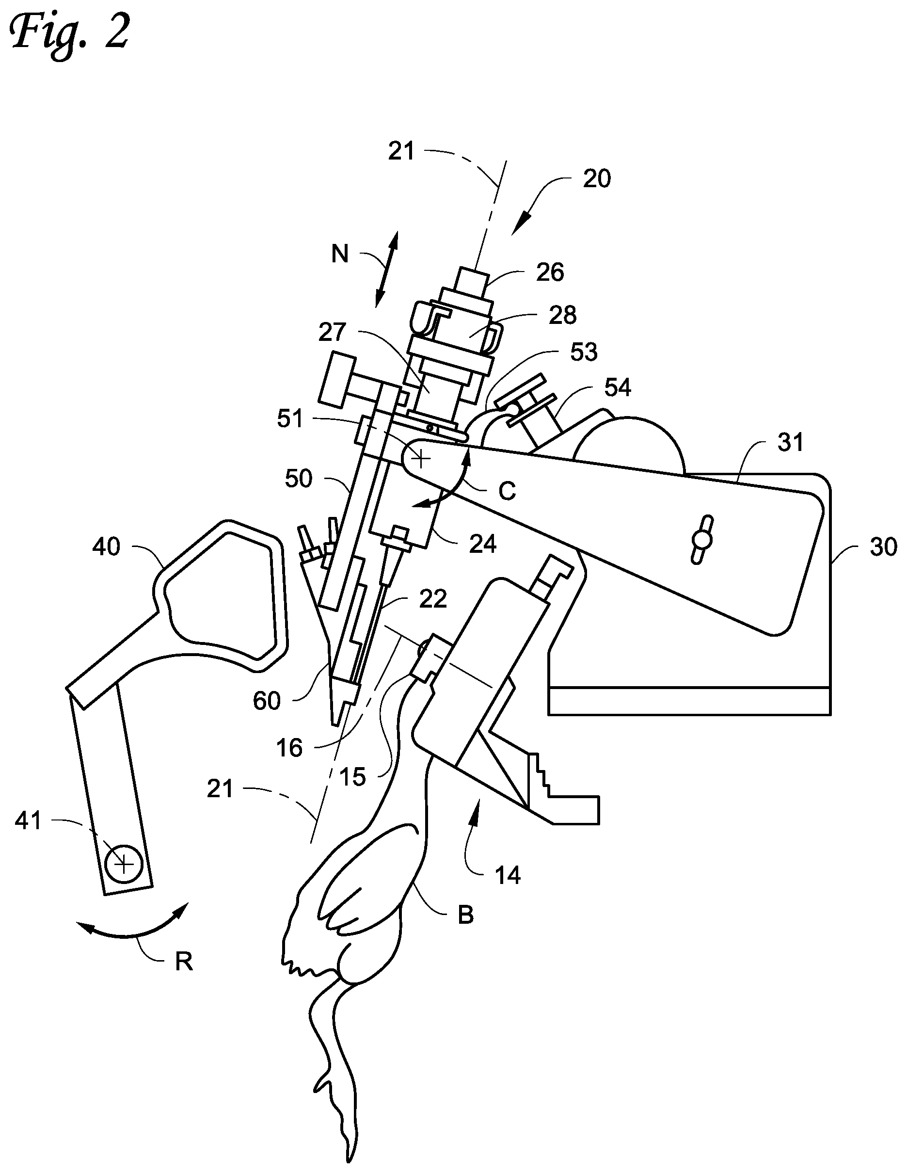 Patent US11771538 Figure 2 – Injection systems and methods