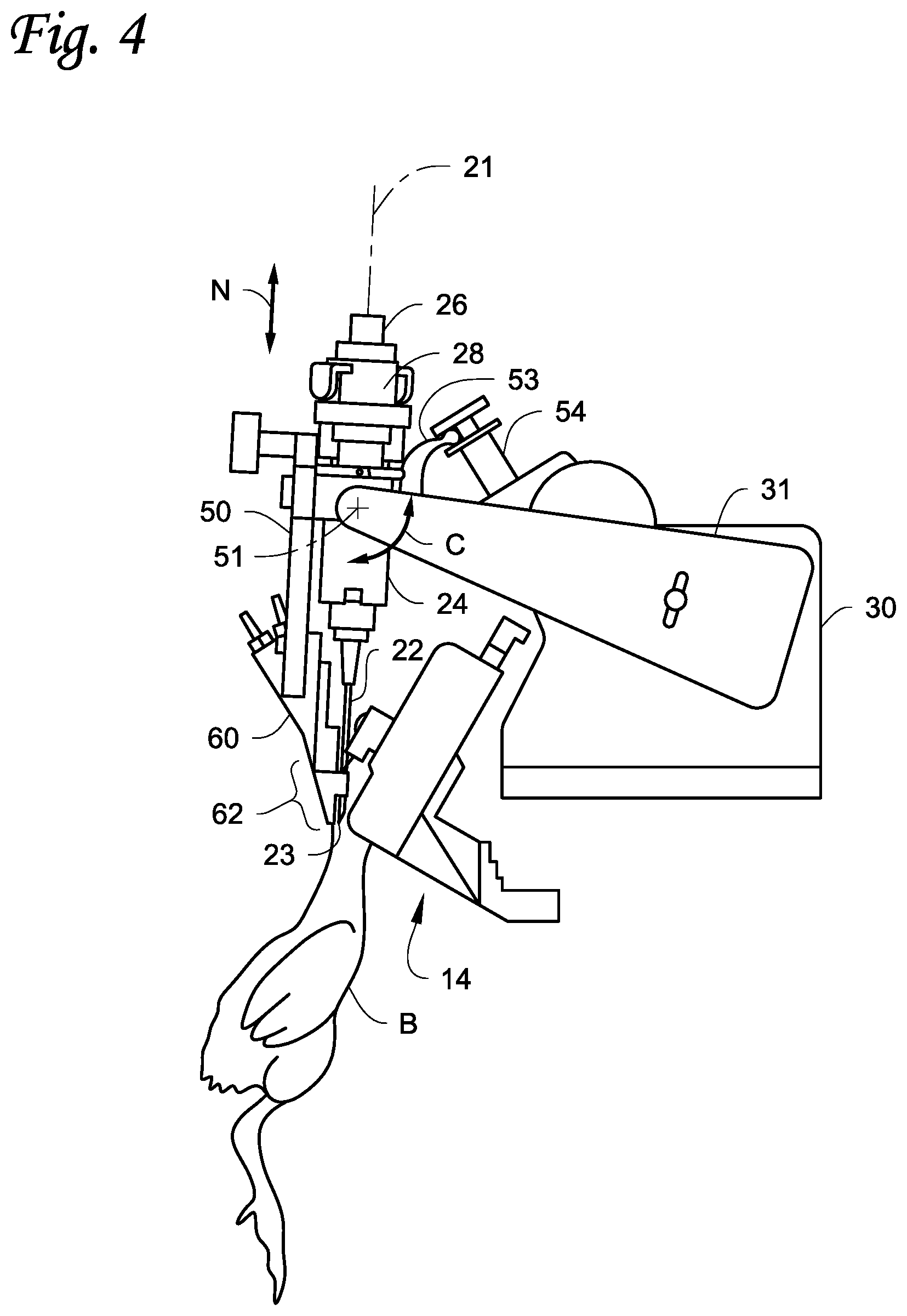 Patent US11771538 Figure 4 – Injection systems and methods
