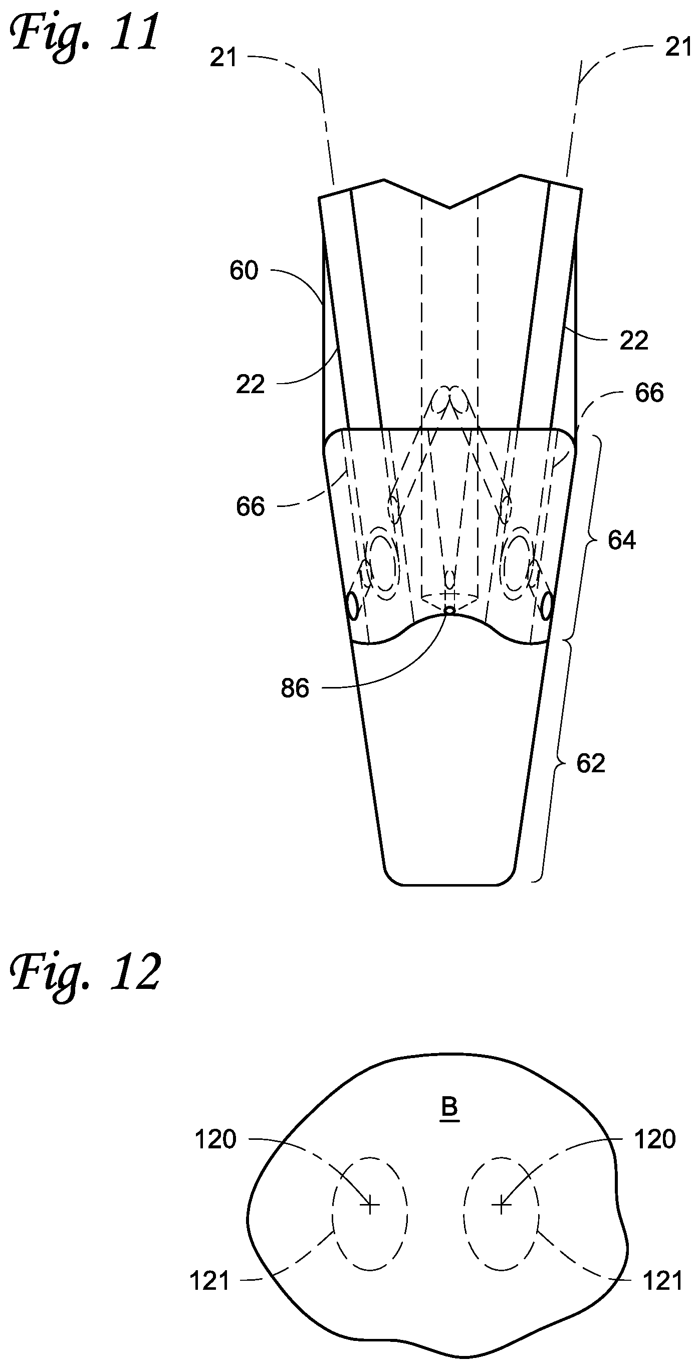 Patent US11771538 Figure 11 – Injection systems and methods