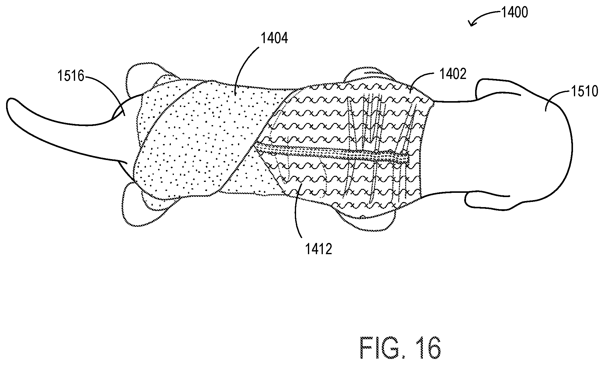 Patent US11771540 Figure 10 – Support device for quadrupeds