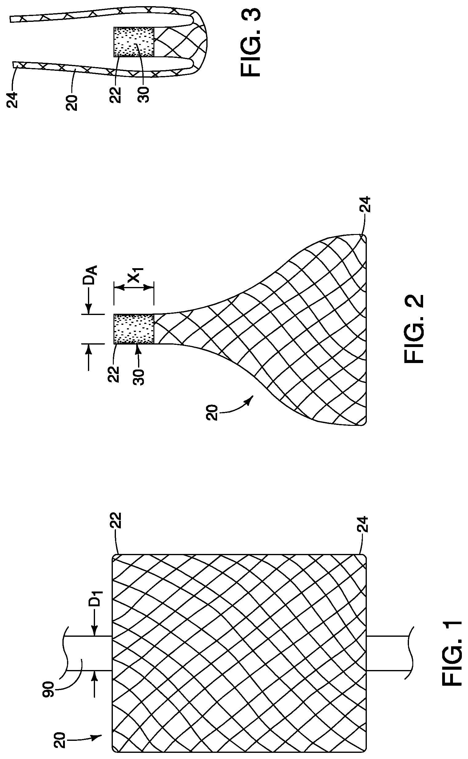 Patent US11771541 Figure 1 – Expandable mesh with locking feature