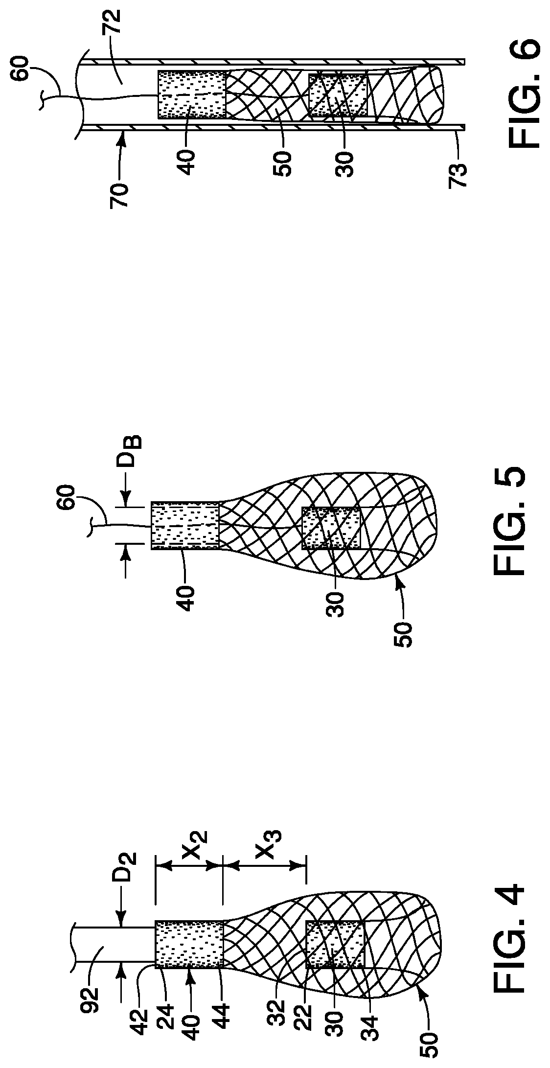 Patent US11771541 Figure 2 – Expandable mesh with locking feature