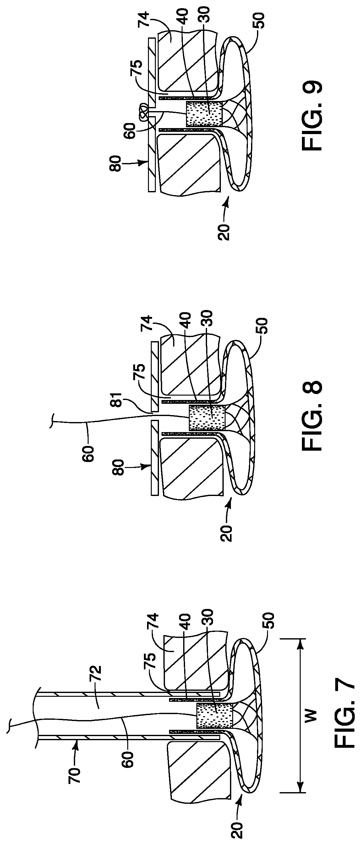 Patent US11771541 Figure 3 – Expandable mesh with locking feature