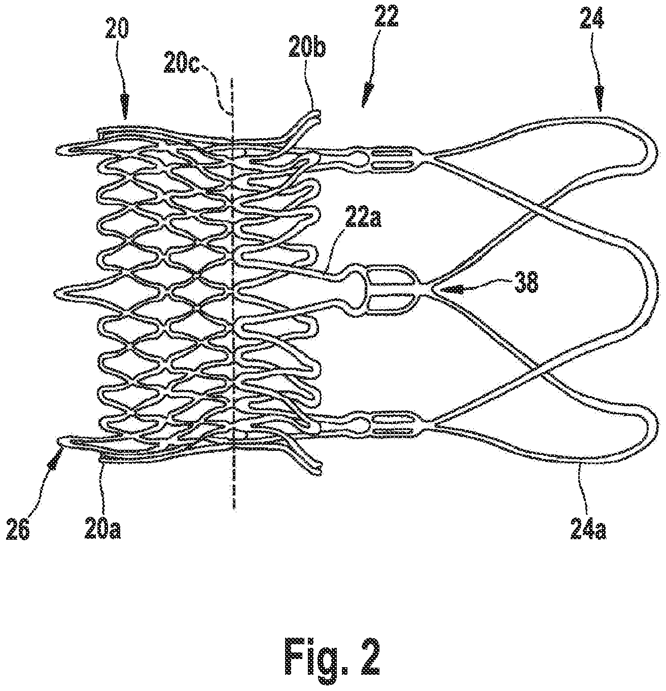 Patent US11771544 Figure 2 – Method and apparatus for compressing/loading stent-valves