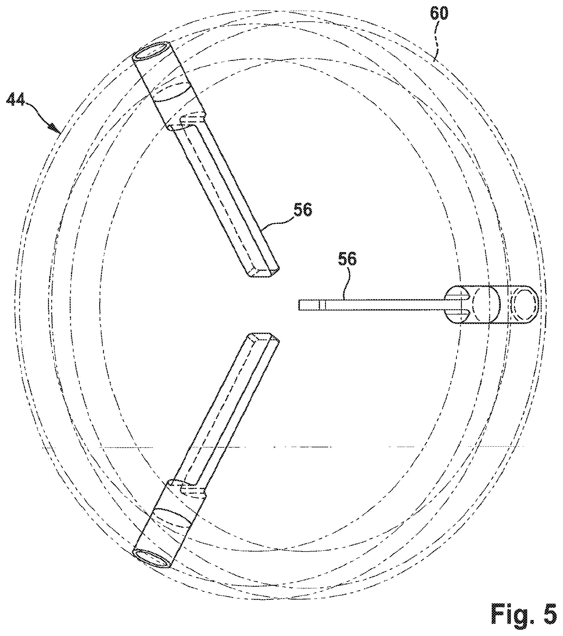 Patent US11771544 Figure 5 – Method and apparatus for compressing/loading stent-valves