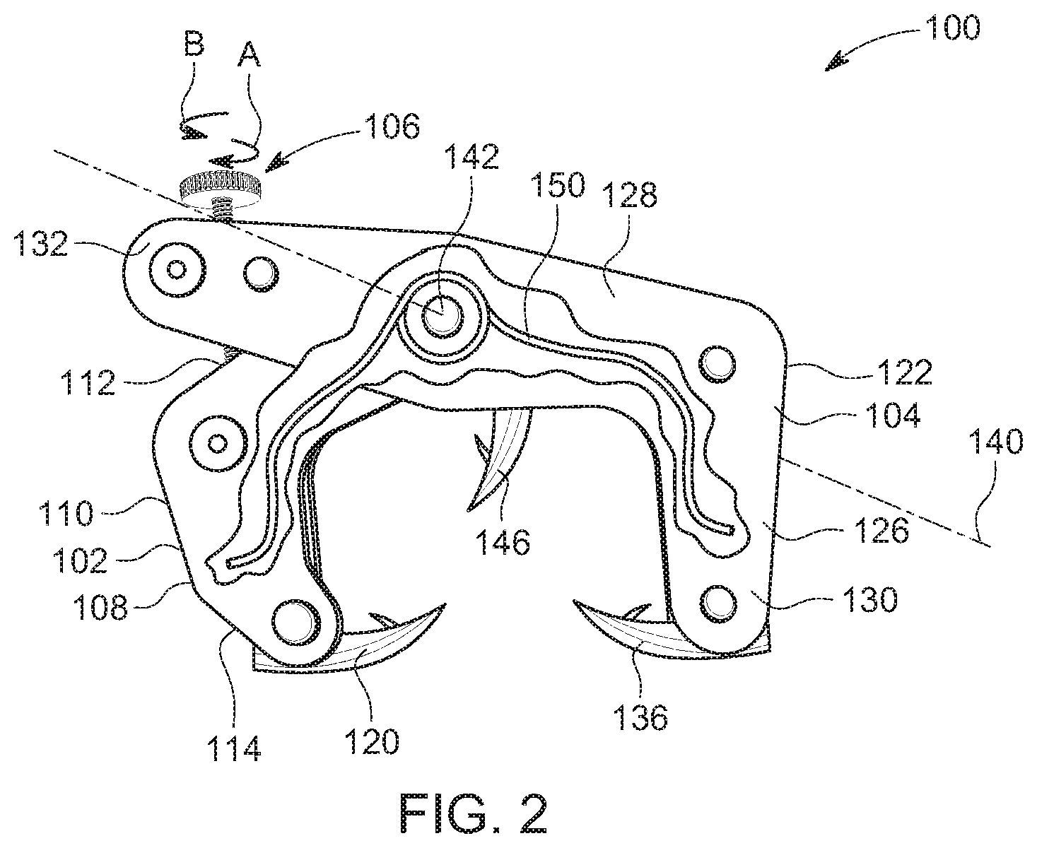 Patent US11771545 Figure 2 – Prosthesis for trachea