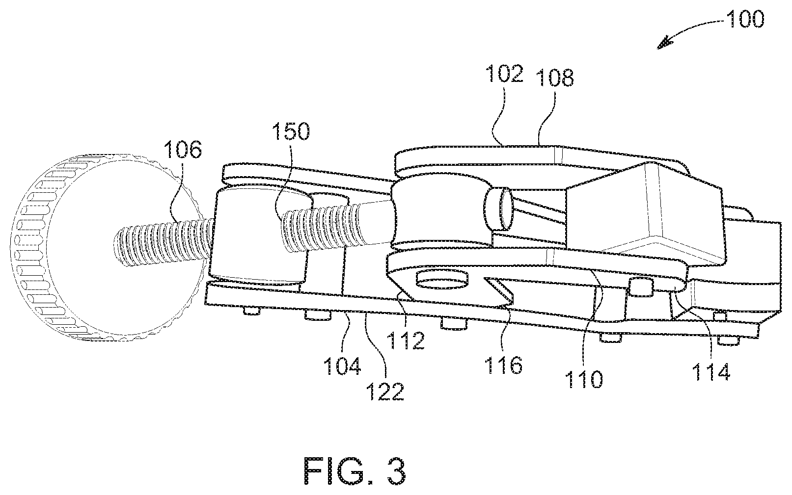 Patent US11771545 Figure 3 – Prosthesis for trachea