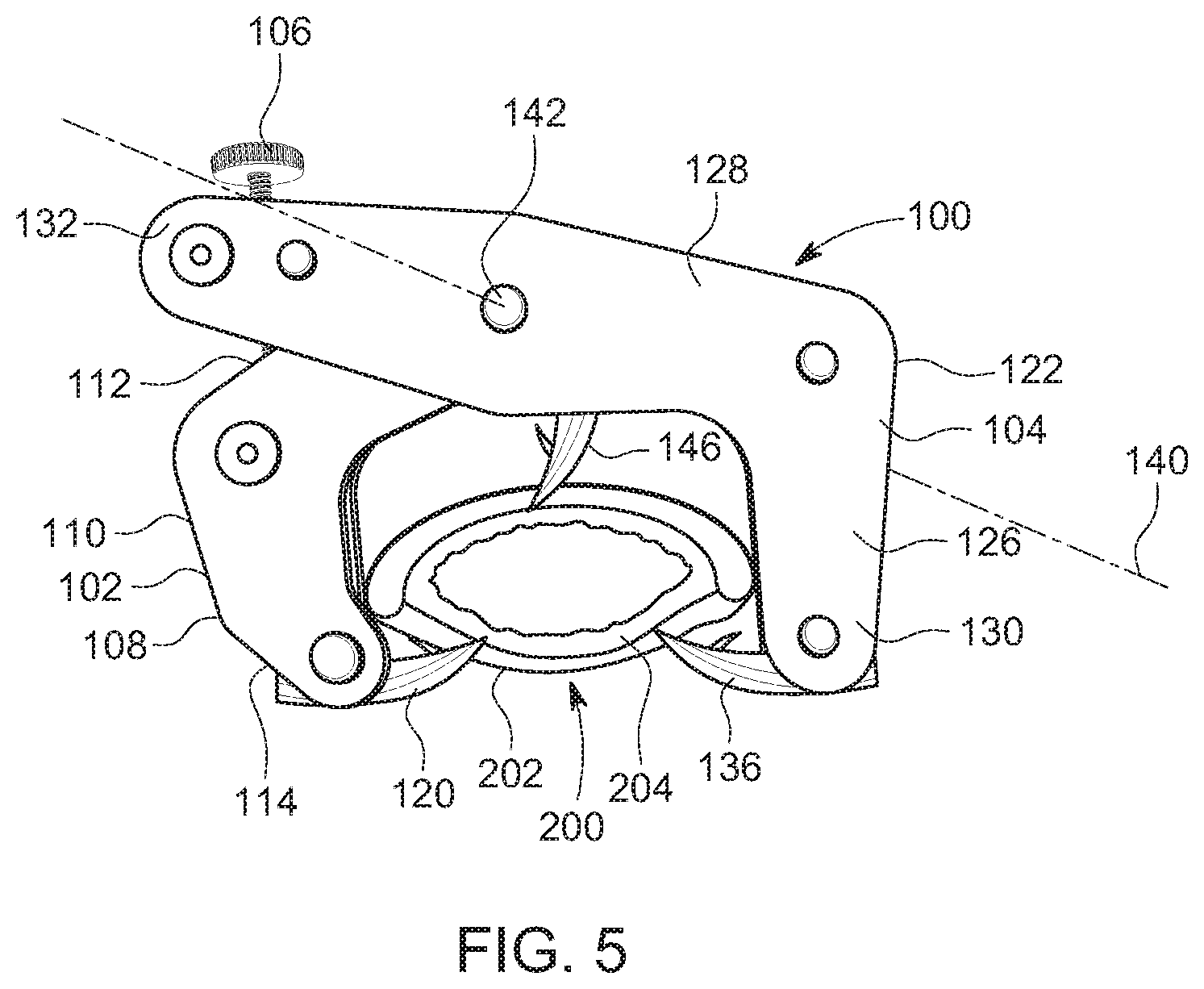 Patent US11771545 Figure 5 – Prosthesis for trachea