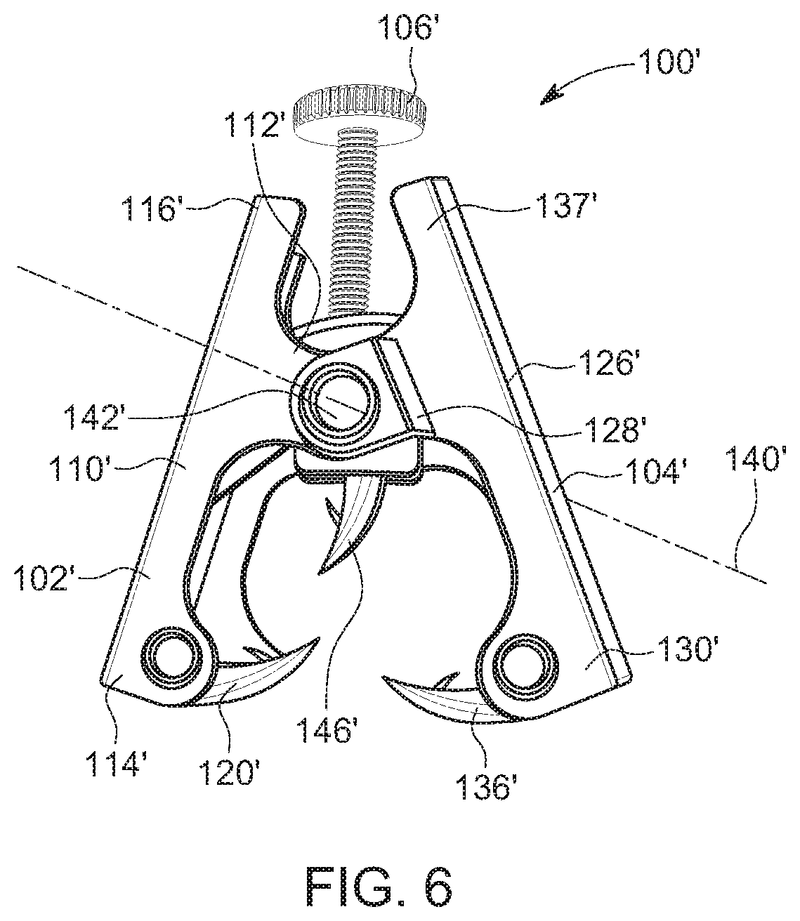 Patent US11771545 Figure 6 – Prosthesis for trachea