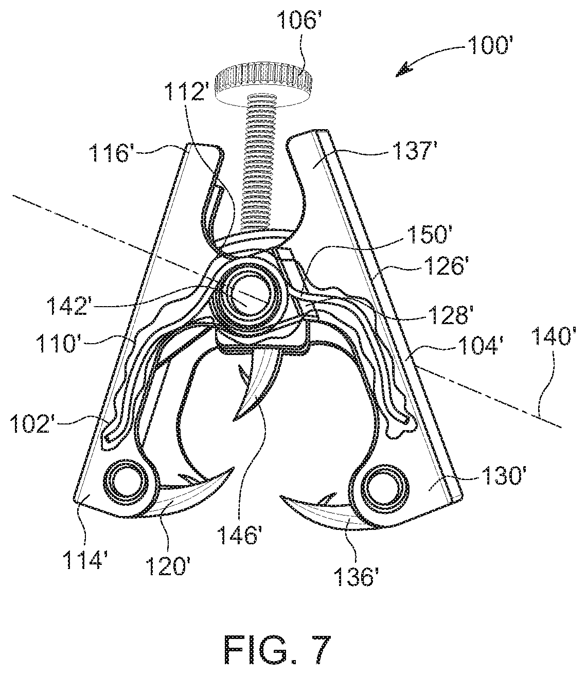 Patent US11771545 Figure 7 – Prosthesis for trachea