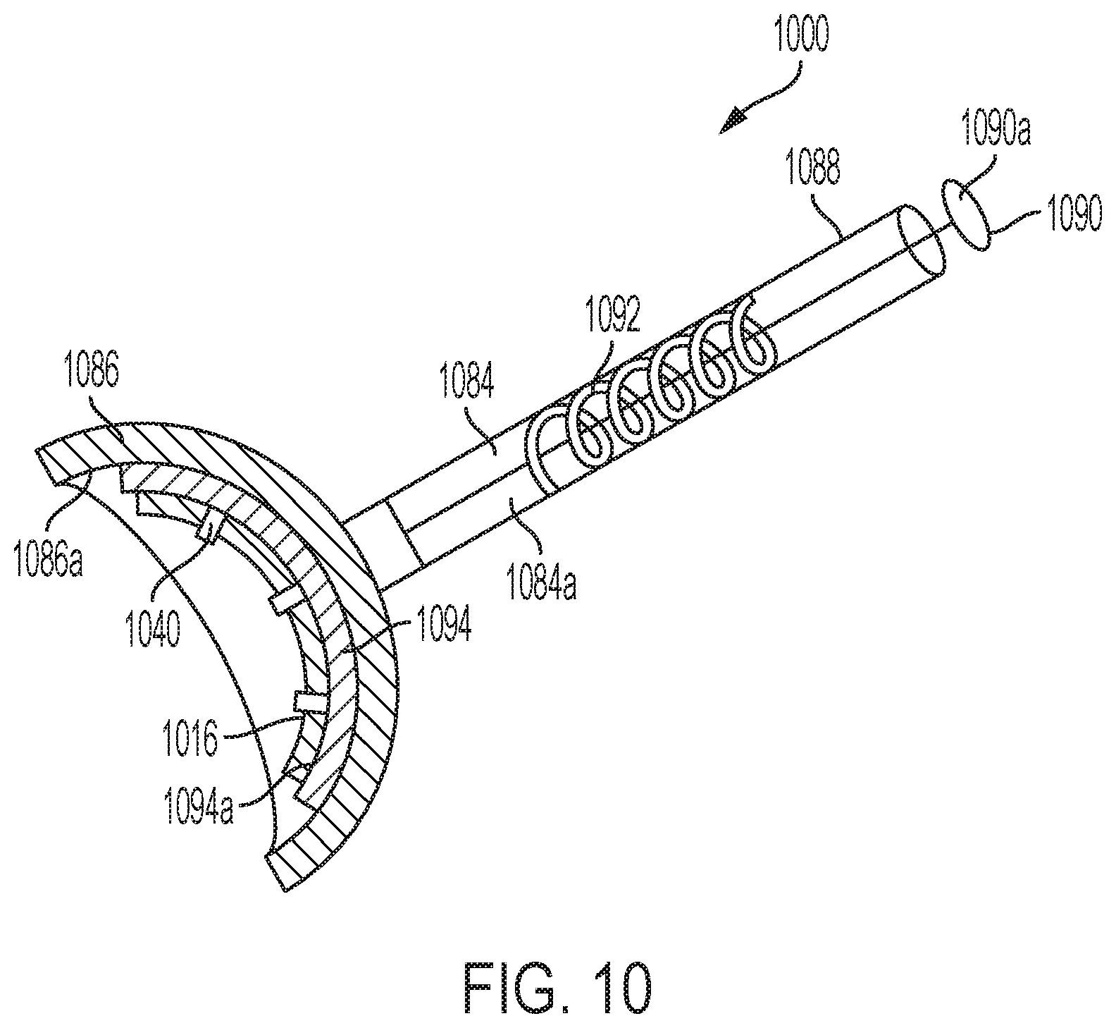 Patent US11771549 Figure 20 – Implantable articles for attaching tendons and/or ligaments to bone and/or cartilage, assemblies thereof, and methods of use thereof