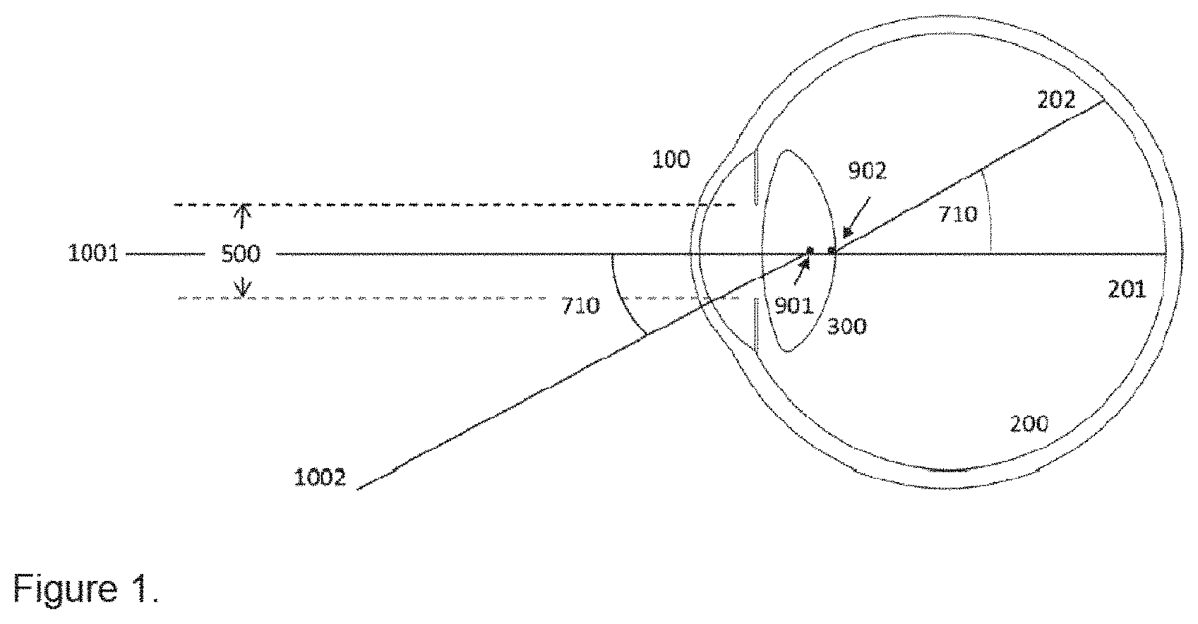 Patent US11771551 Figure 1 – Method to design and manufacture an intraocular lens