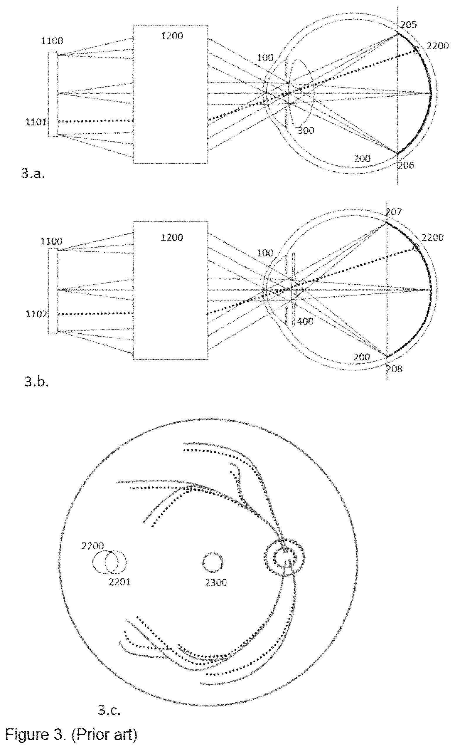 Patent US11771551 Figure 3 – Method to design and manufacture an intraocular lens