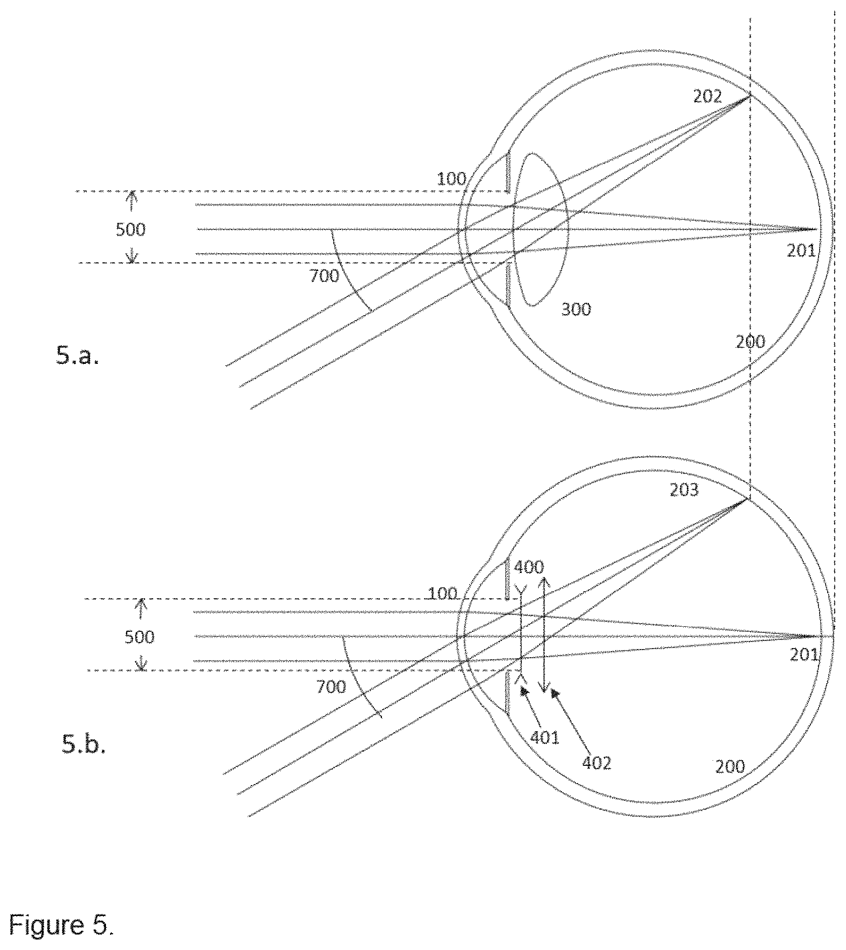 Patent US11771551 Figure 5 – Method to design and manufacture an intraocular lens